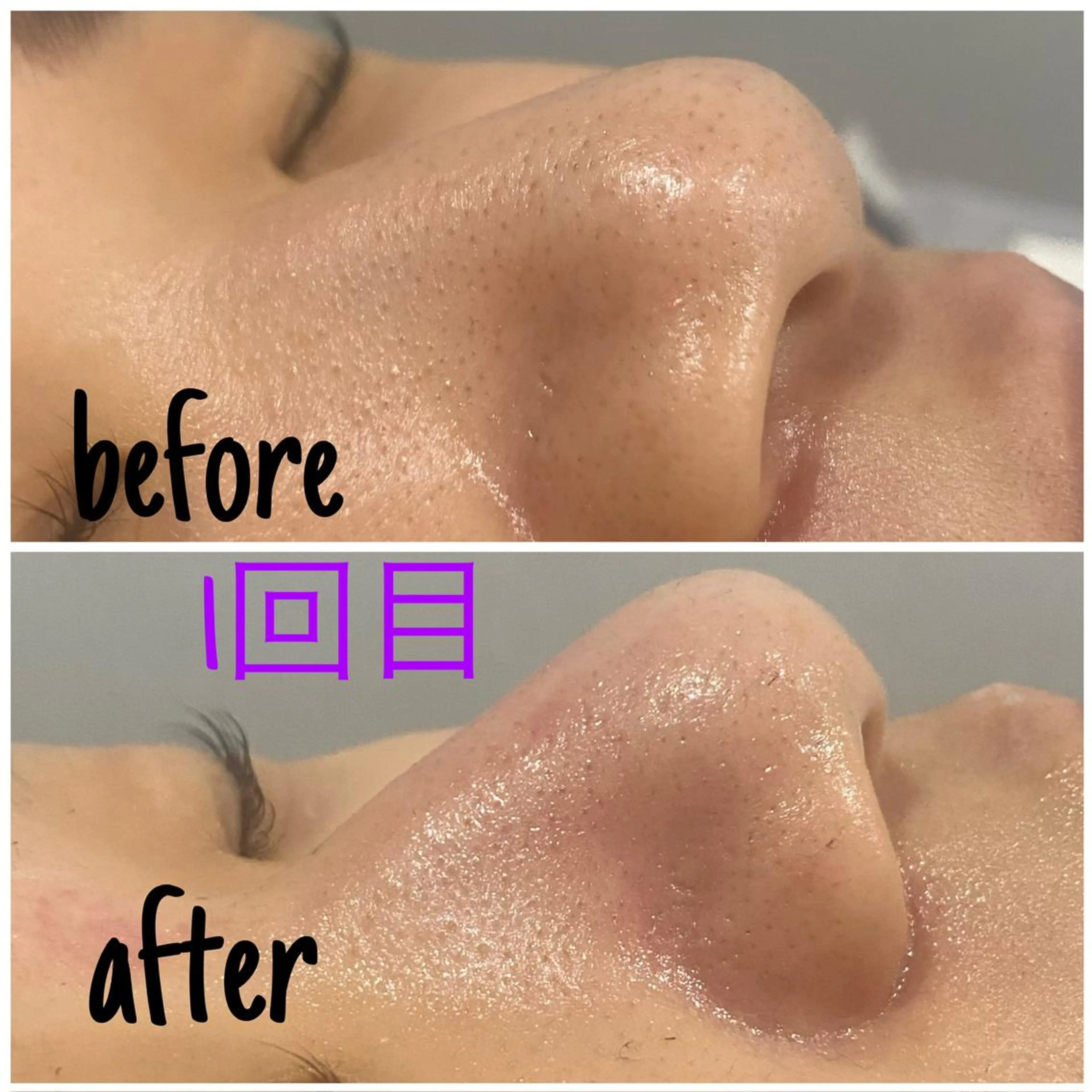 アルカンジュ~archange~所属・痩身/毛穴洗浄/脱毛 アルカンジュのエステ・リラクイメージ