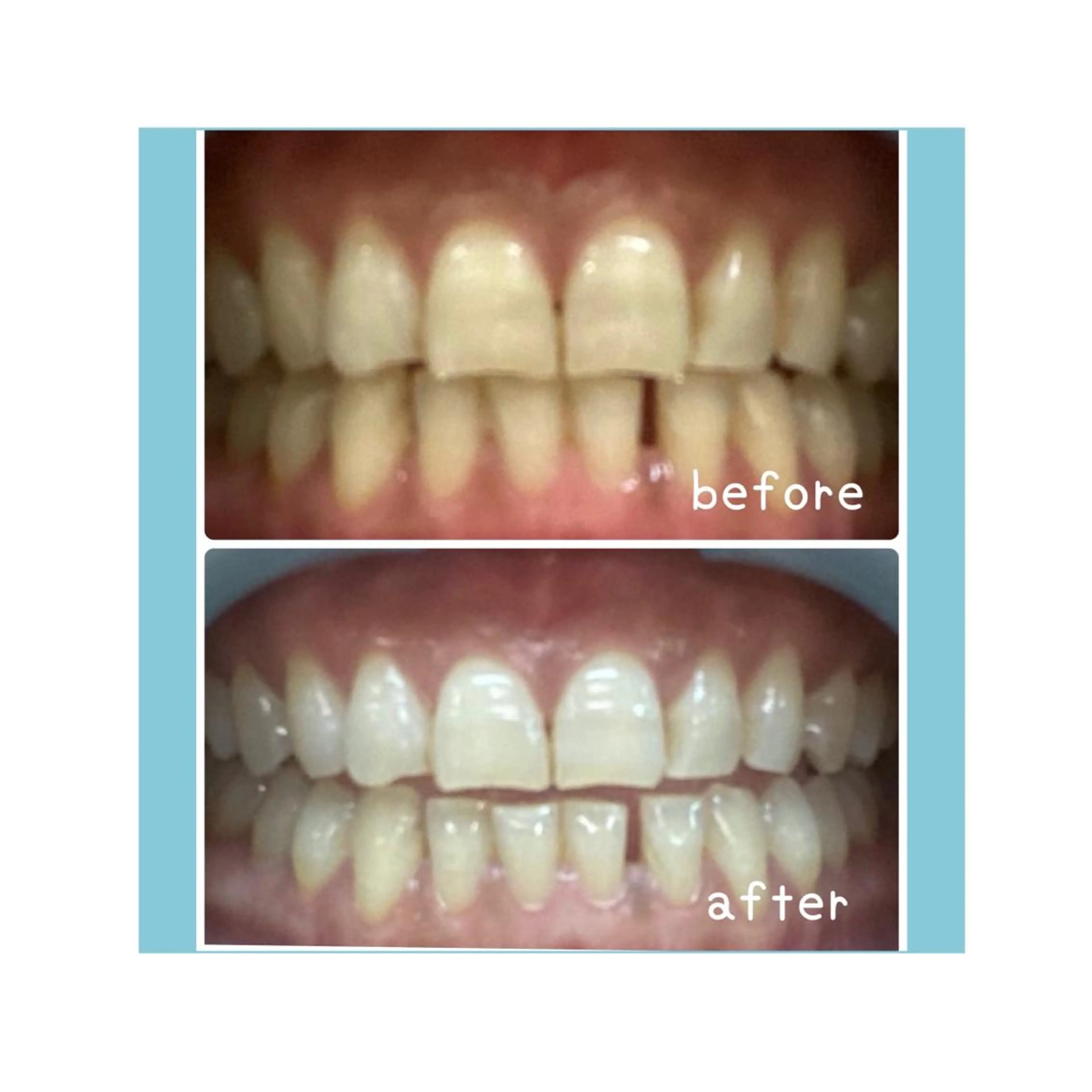 脱毛&フェイシャル BiSTA〈ビスタ〉のエステ・リラクイメージ