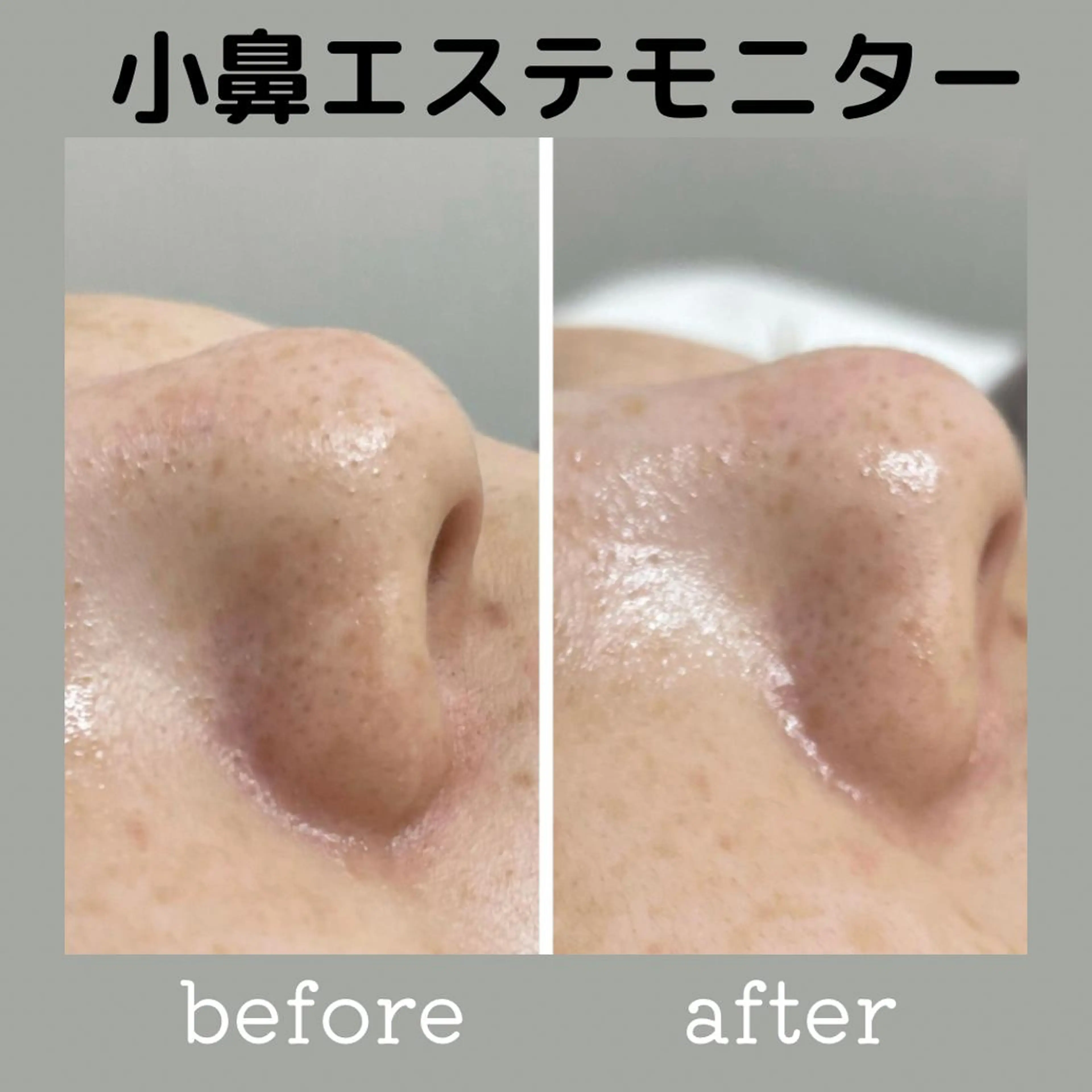 エステ DeI'm   名古屋栄所属・小林 玲菜のエステ・リラクイメージ