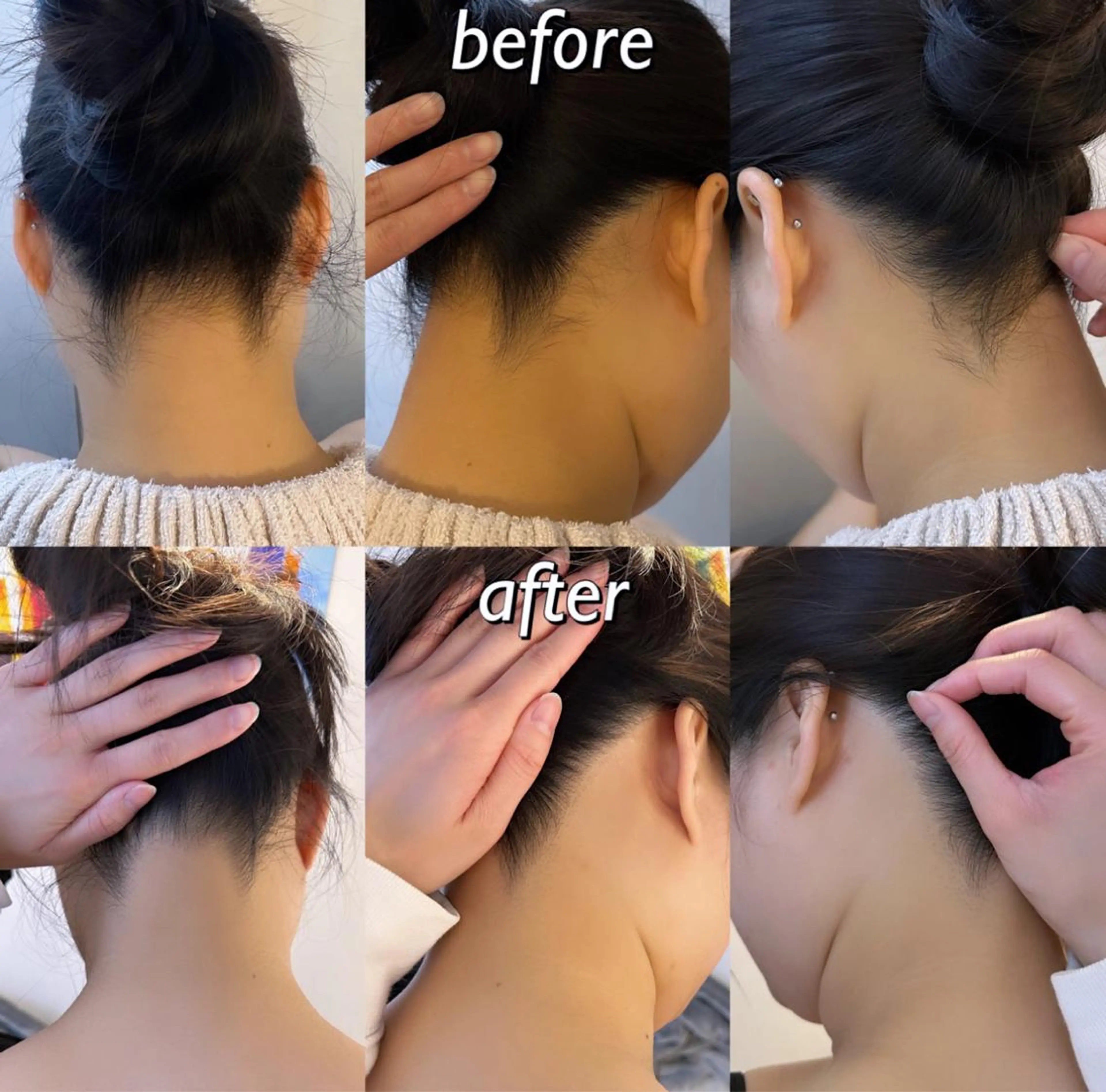 うなじ脱毛/美肌脱毛 LABELのエステ・リラクイメージ