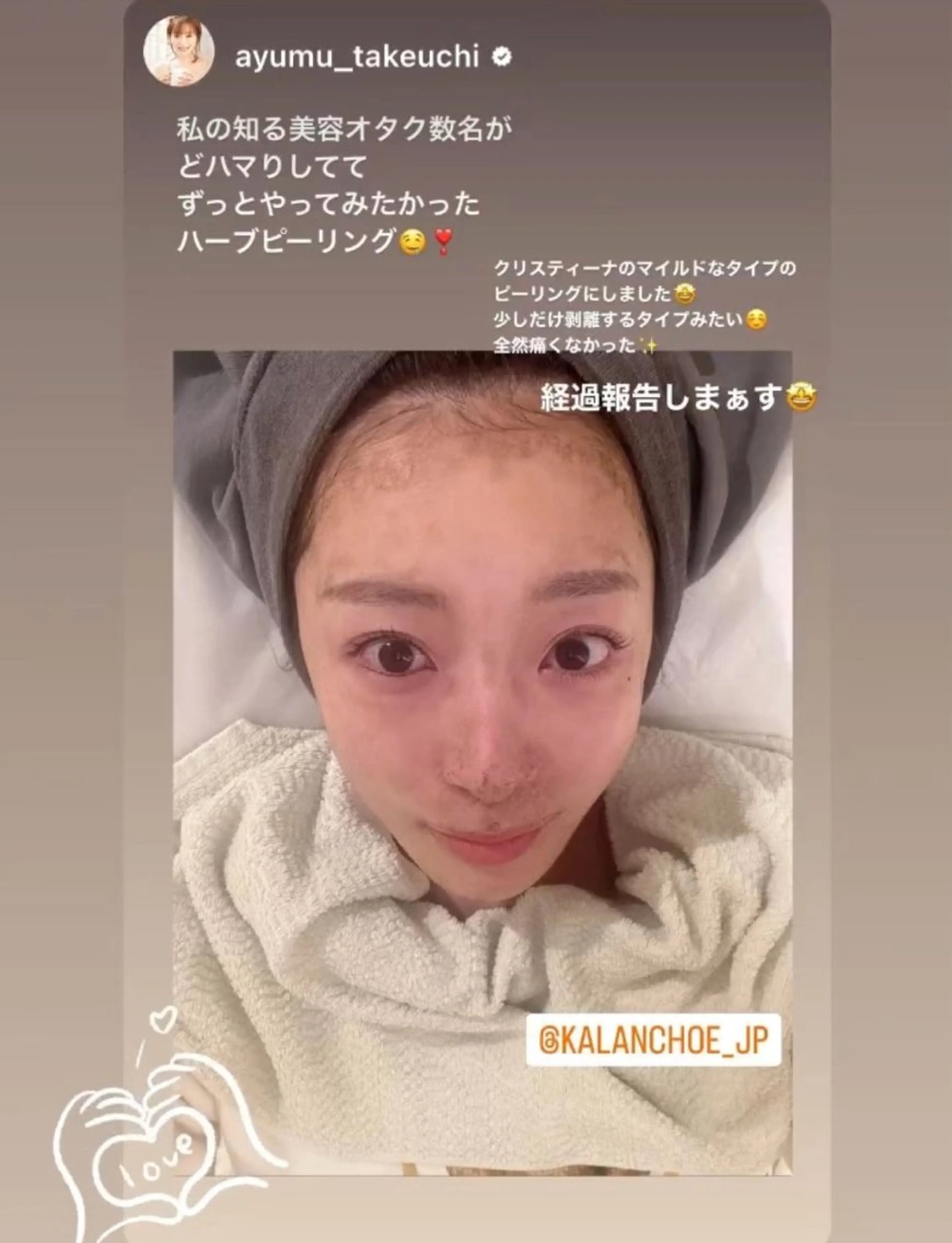 エステ 肌質改善 KALANCHOEのエステ・リラクイメージ