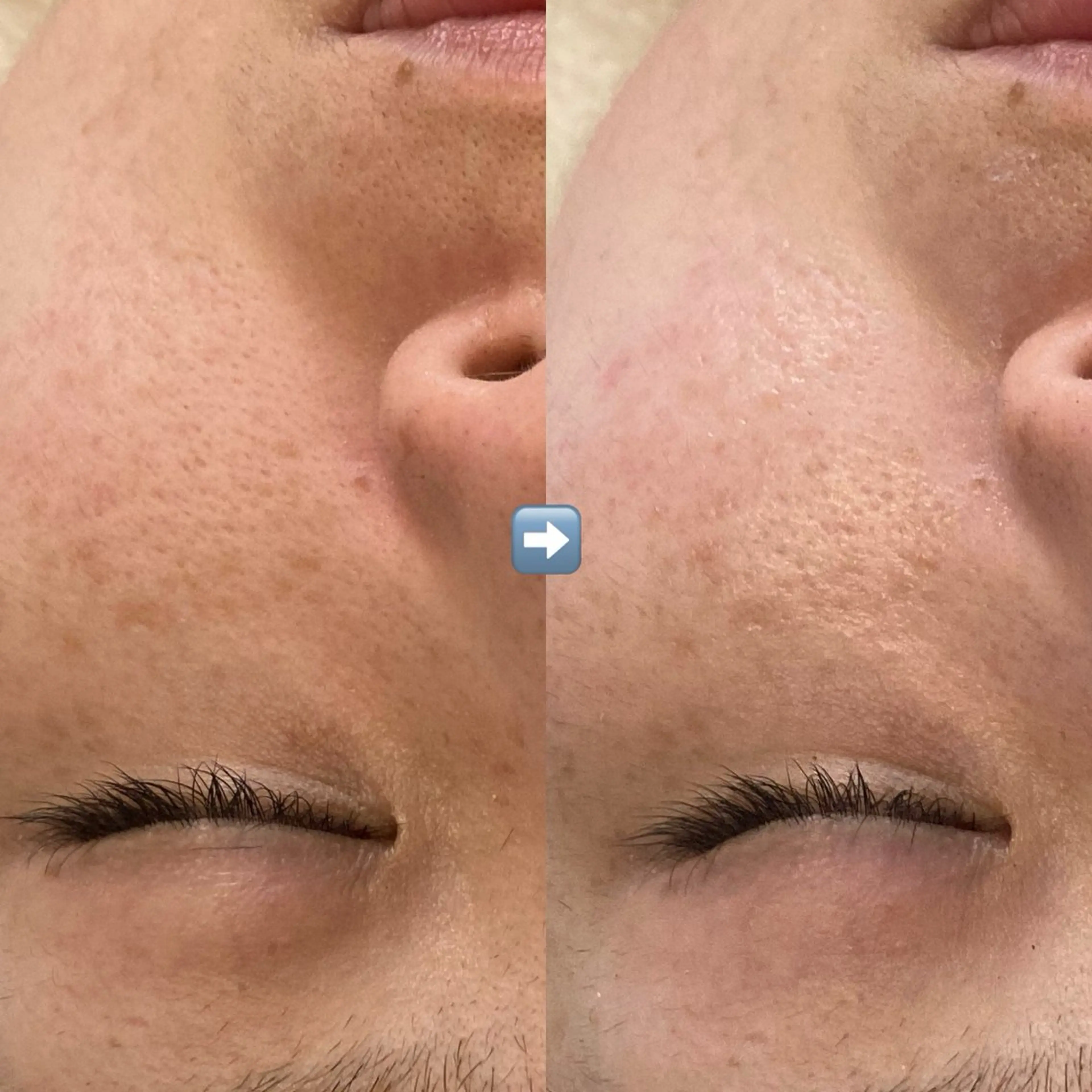 たるみ改善小顔エステ 堀葉月のその他イメージ