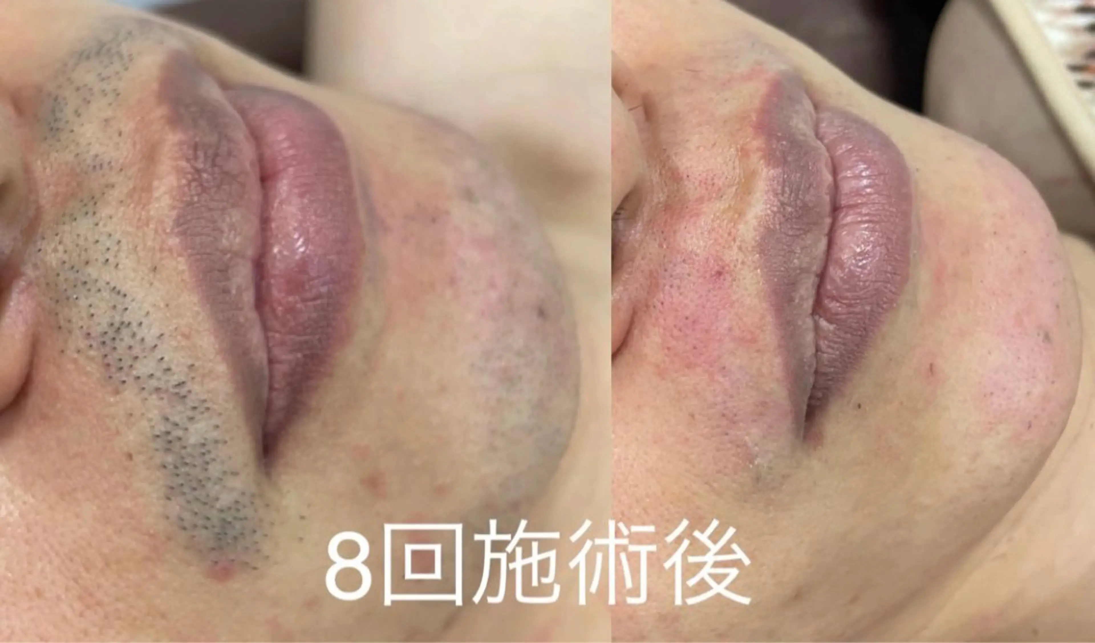 ネフェル所属・ネフェル Neferのエステ・リラクイメージ