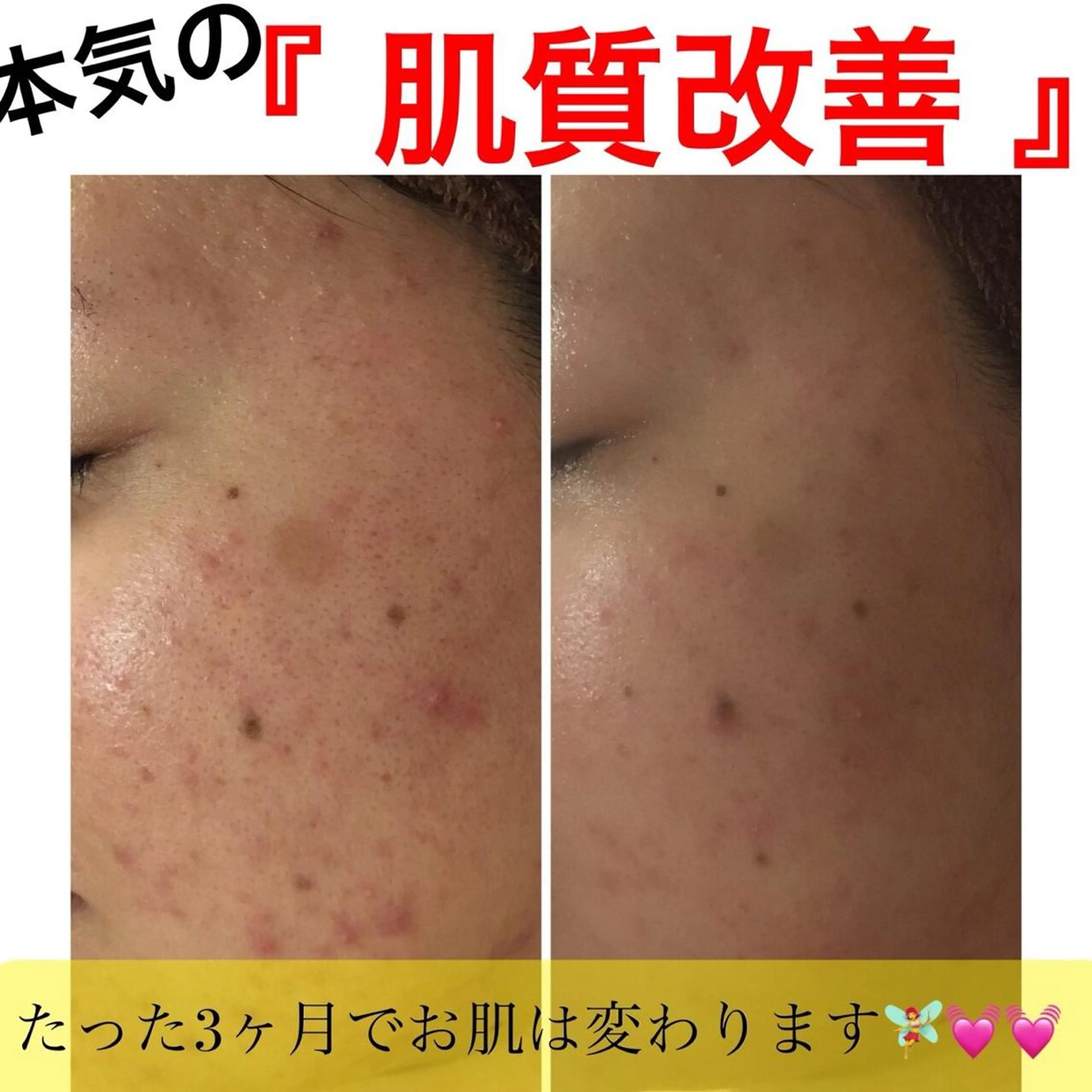 ミディアム カラー パーマ ヘアアレンジ メンズ キッズ ネイル マツエク・マツパ ニキビ・肌質改善専門 ♡人生が変わるサロンのエステ・リラクイメージ