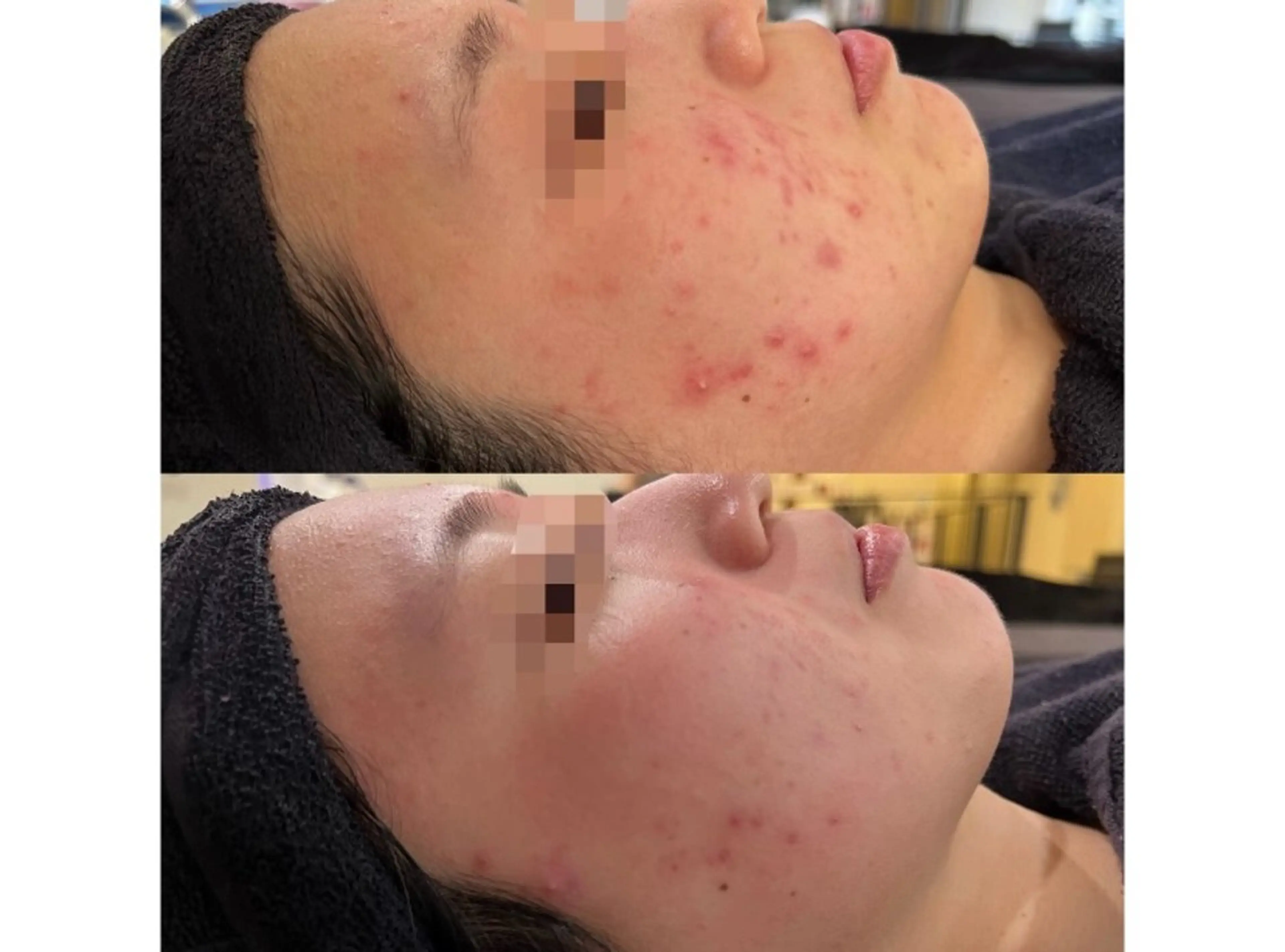 エステ 松島 愛莉のエステ・リラクイメージ