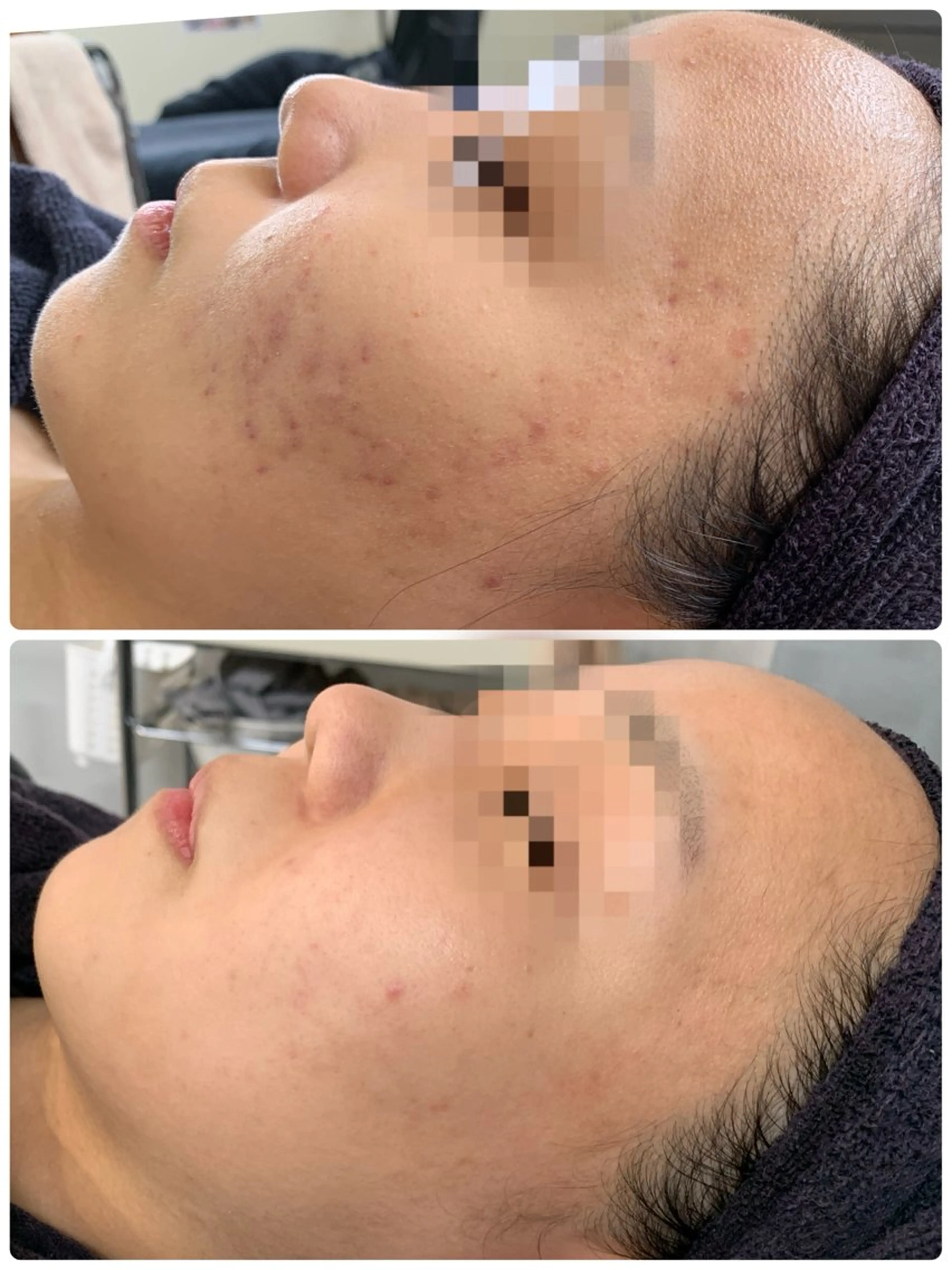 エステ 松島 愛莉のエステ・リラクイメージ