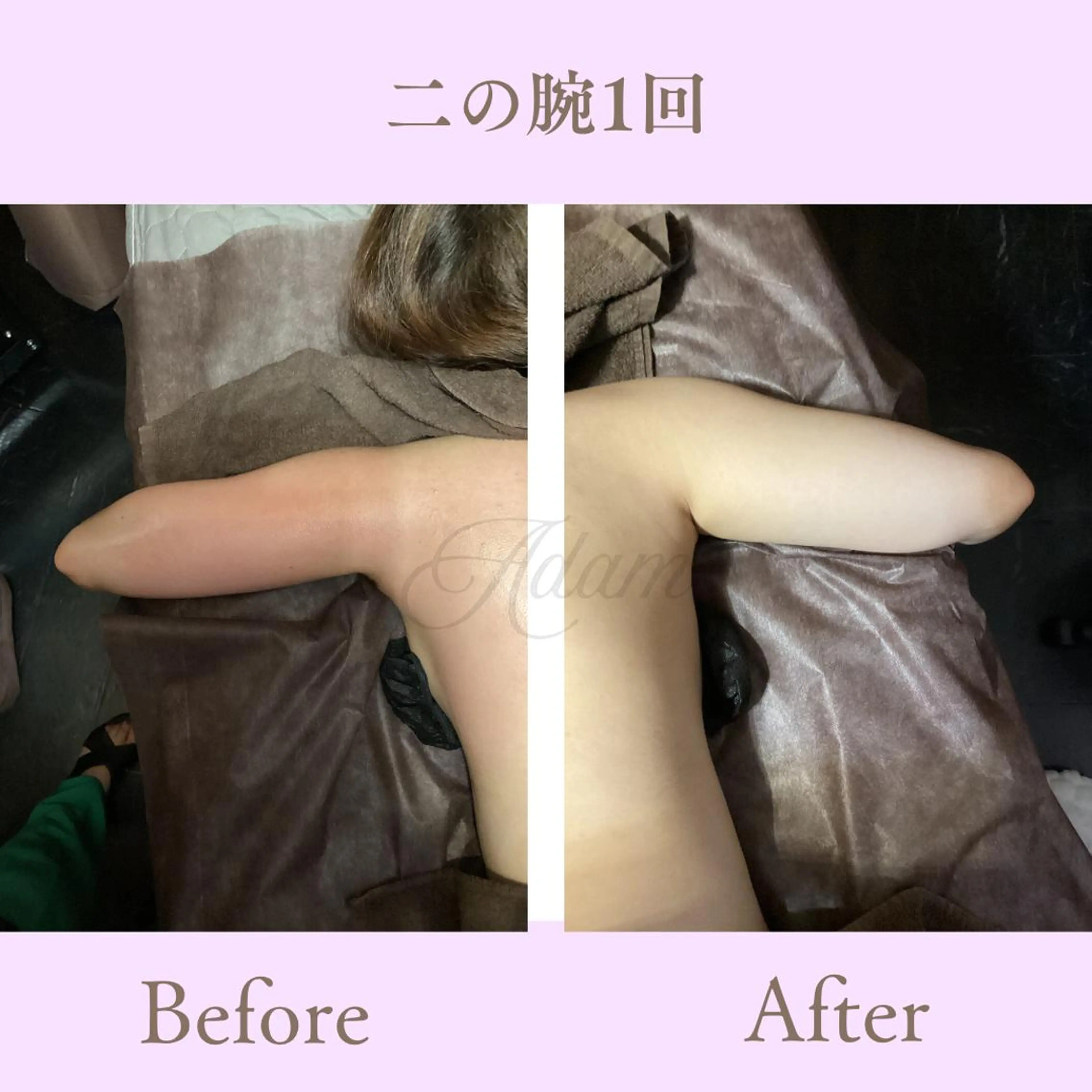 エステ リラク Adam 上半身美人のエステ・リラクイメージ