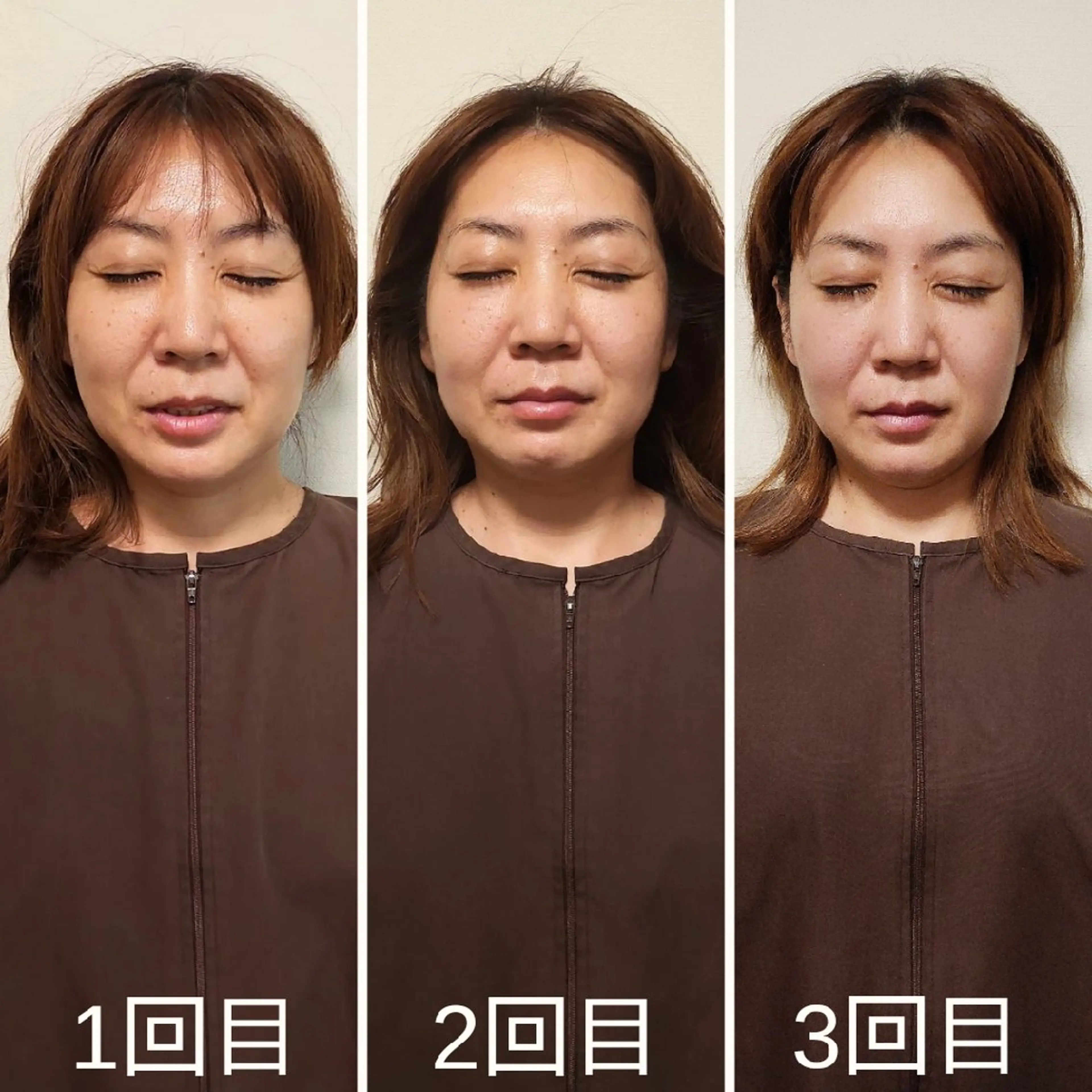 即効⚡小顔美容鍼🪡 むくみたるみ脂肪解消のエステ・リラクイメージ