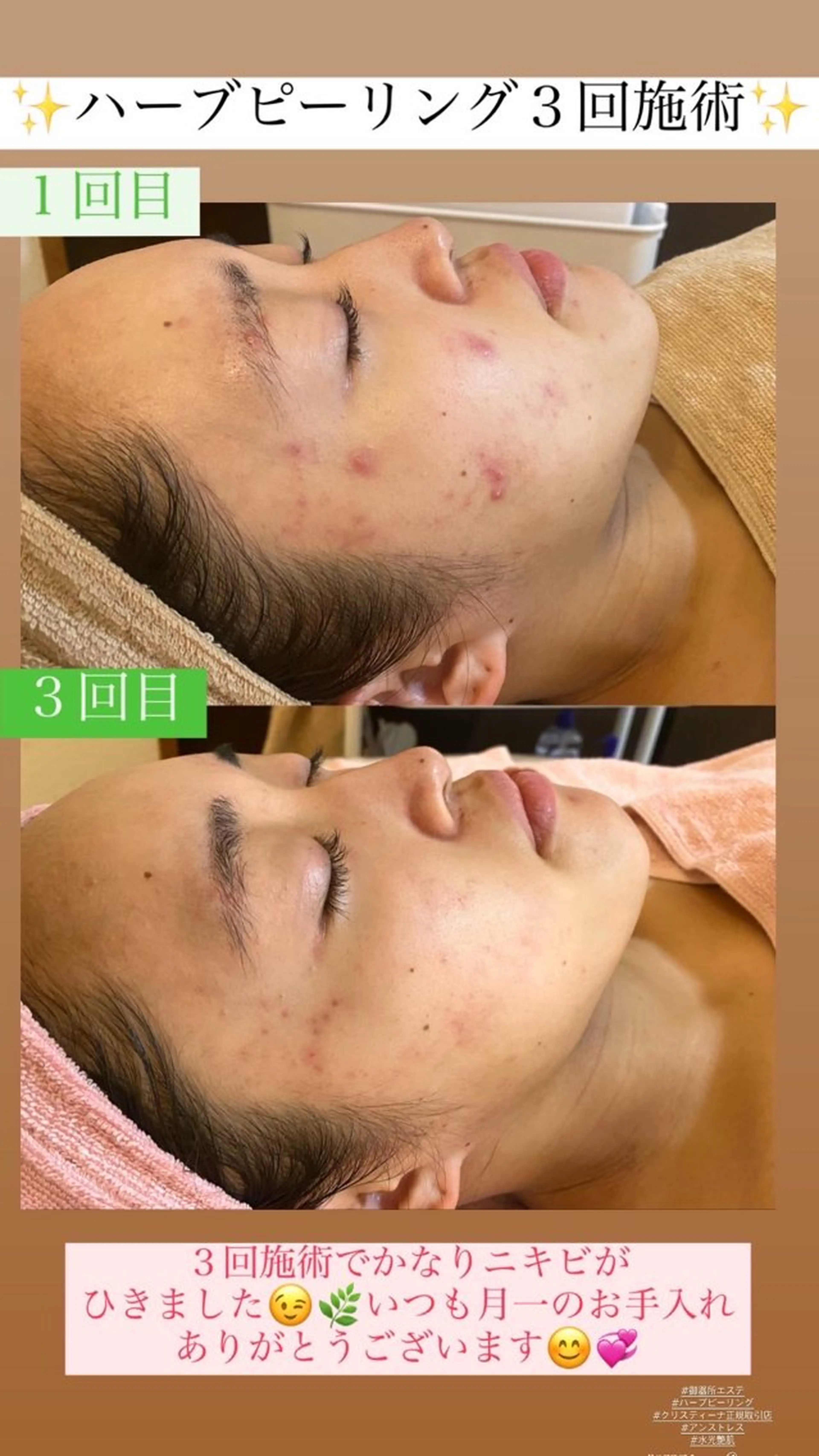 エステ Salon de Lino 御器所のエステ・リラクイメージ