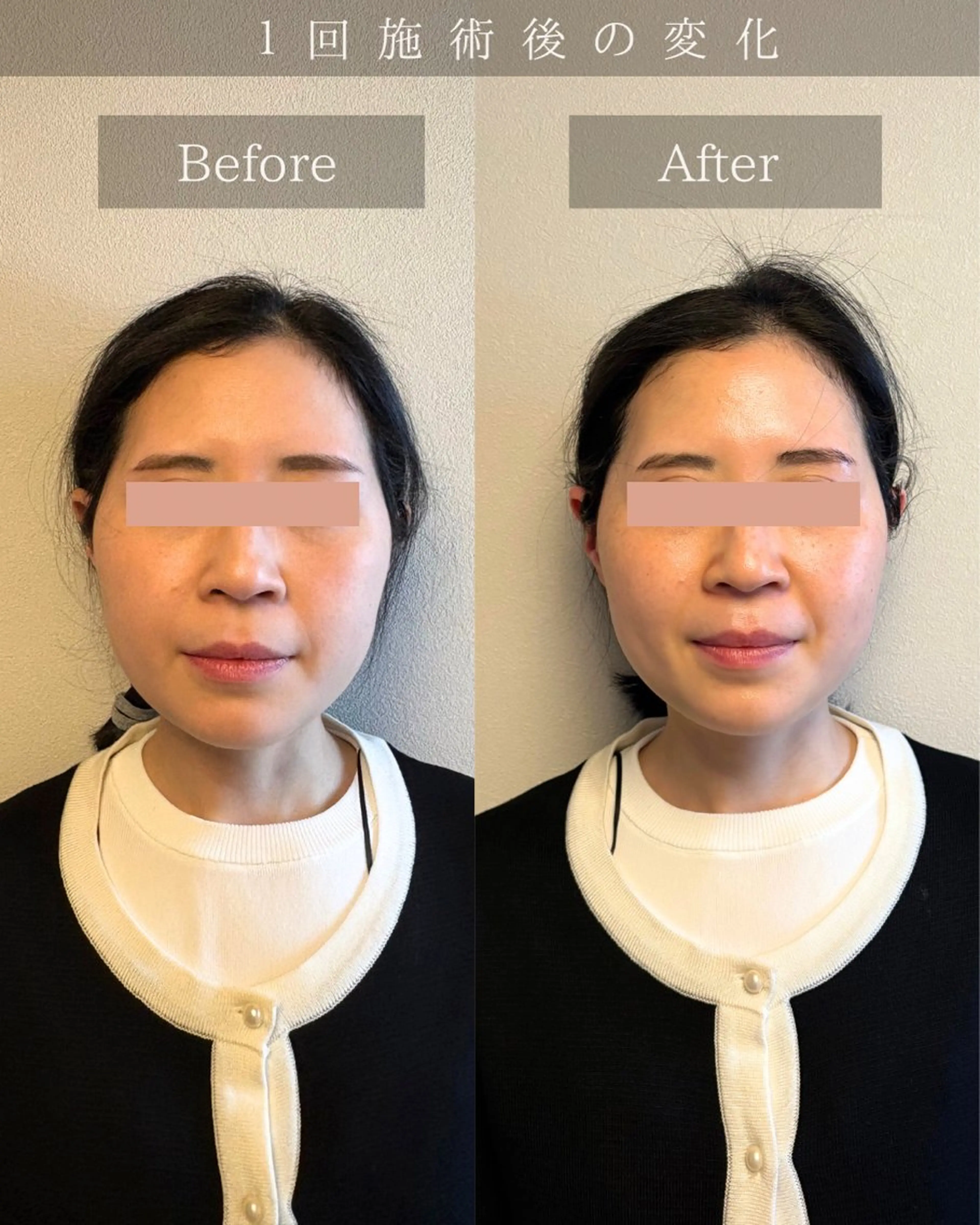 Noelie所属・美肌&小顔矯正 Noelieのエステ・リラクイメージ