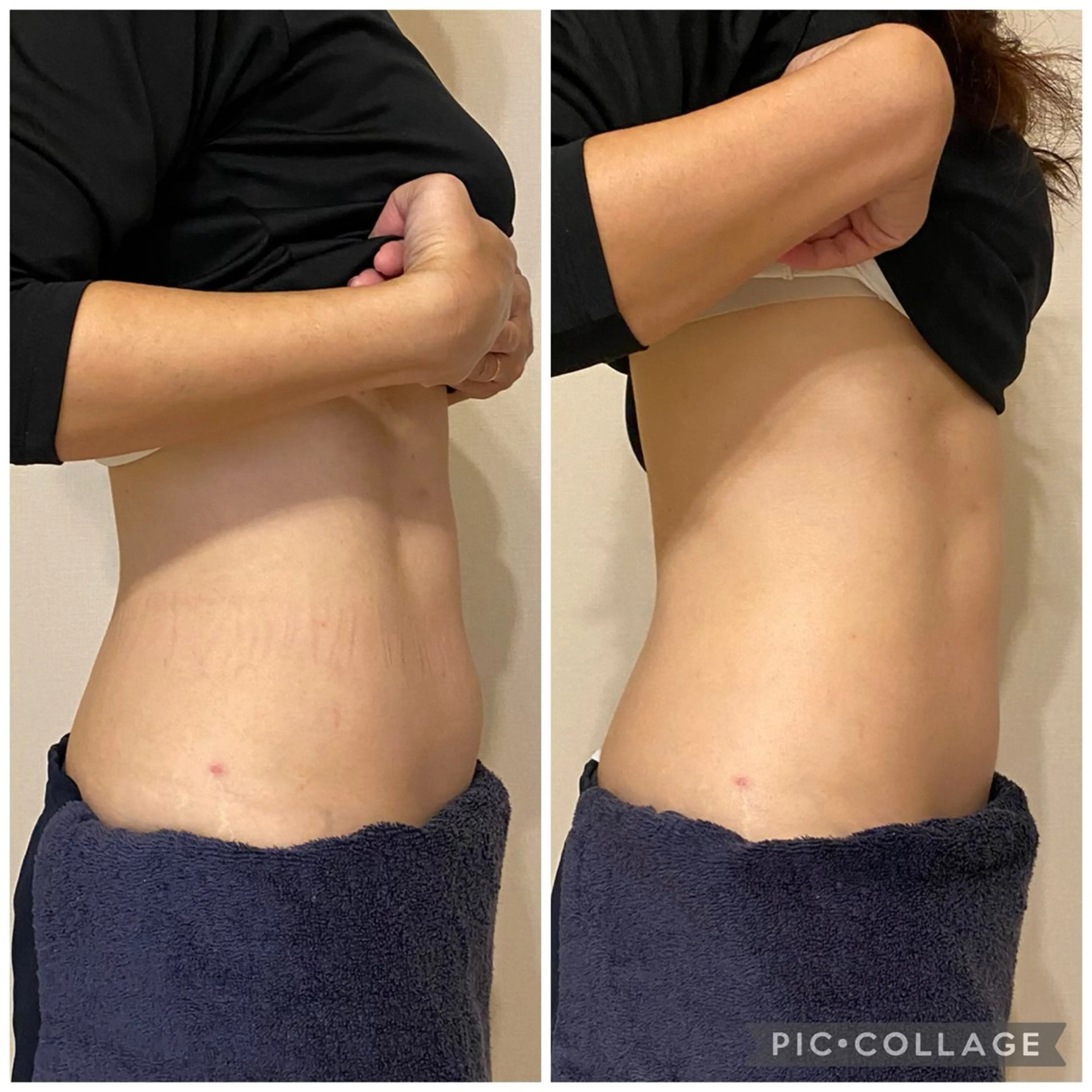 腸セラピーサロン ナチュモアのエステ・リラクイメージ