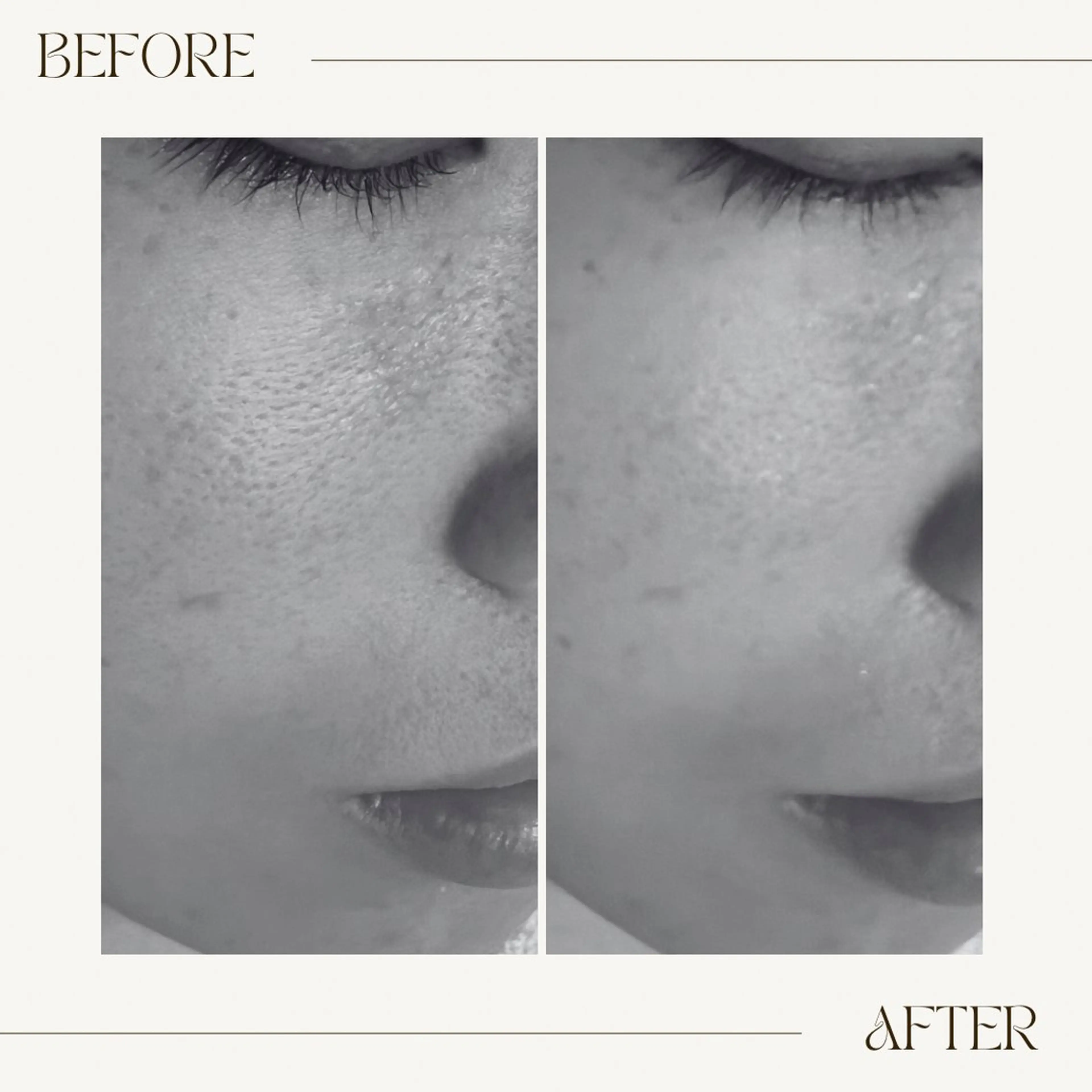 【半額モニター】🩷ベーシックトリートメントの写真