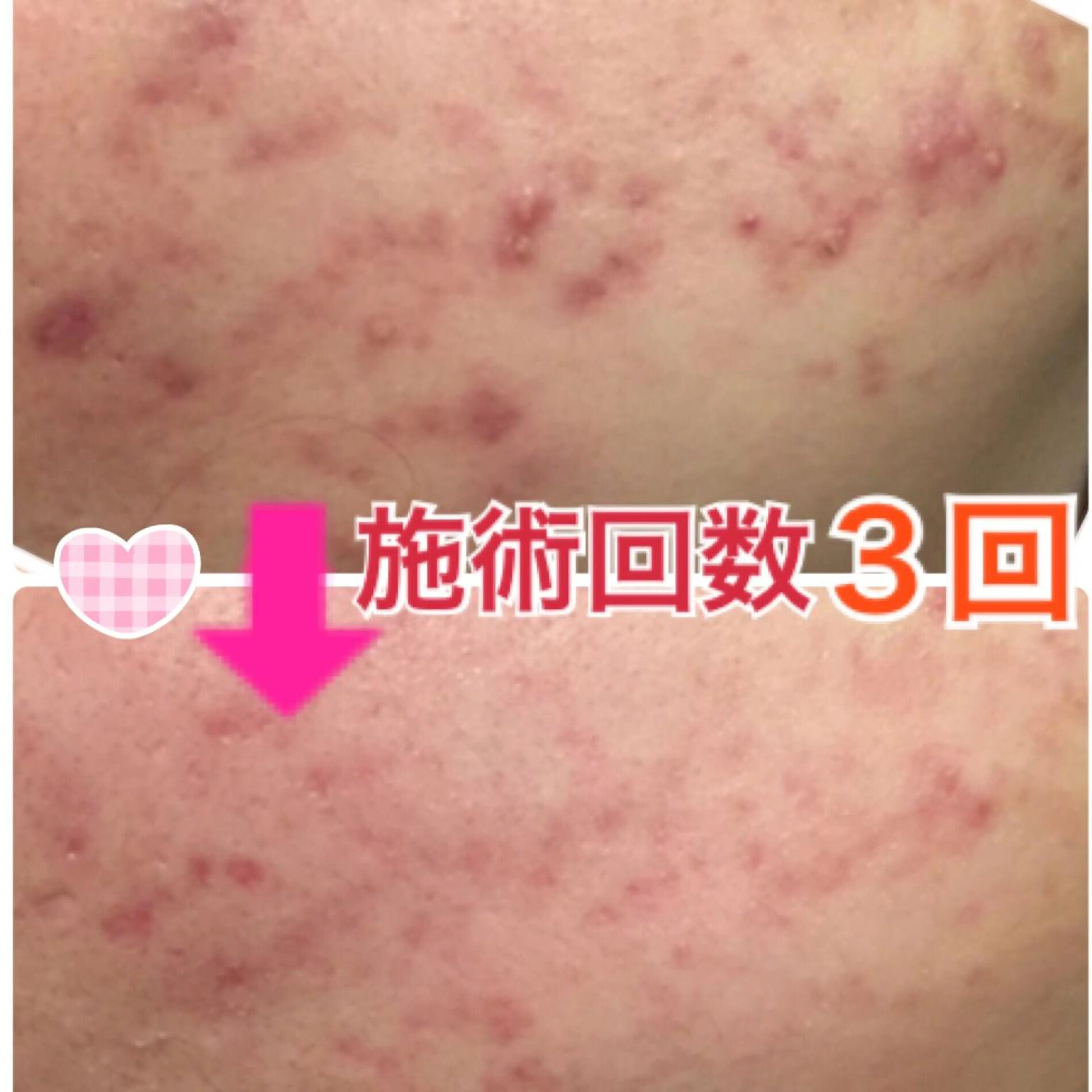 ショート カラー パーマ ヘアアレンジ メンズ キッズ ネイル マツエク・マツパ ‍痩身＆ボディ 結果出し🌟丹野のエステ・リラクイメージ