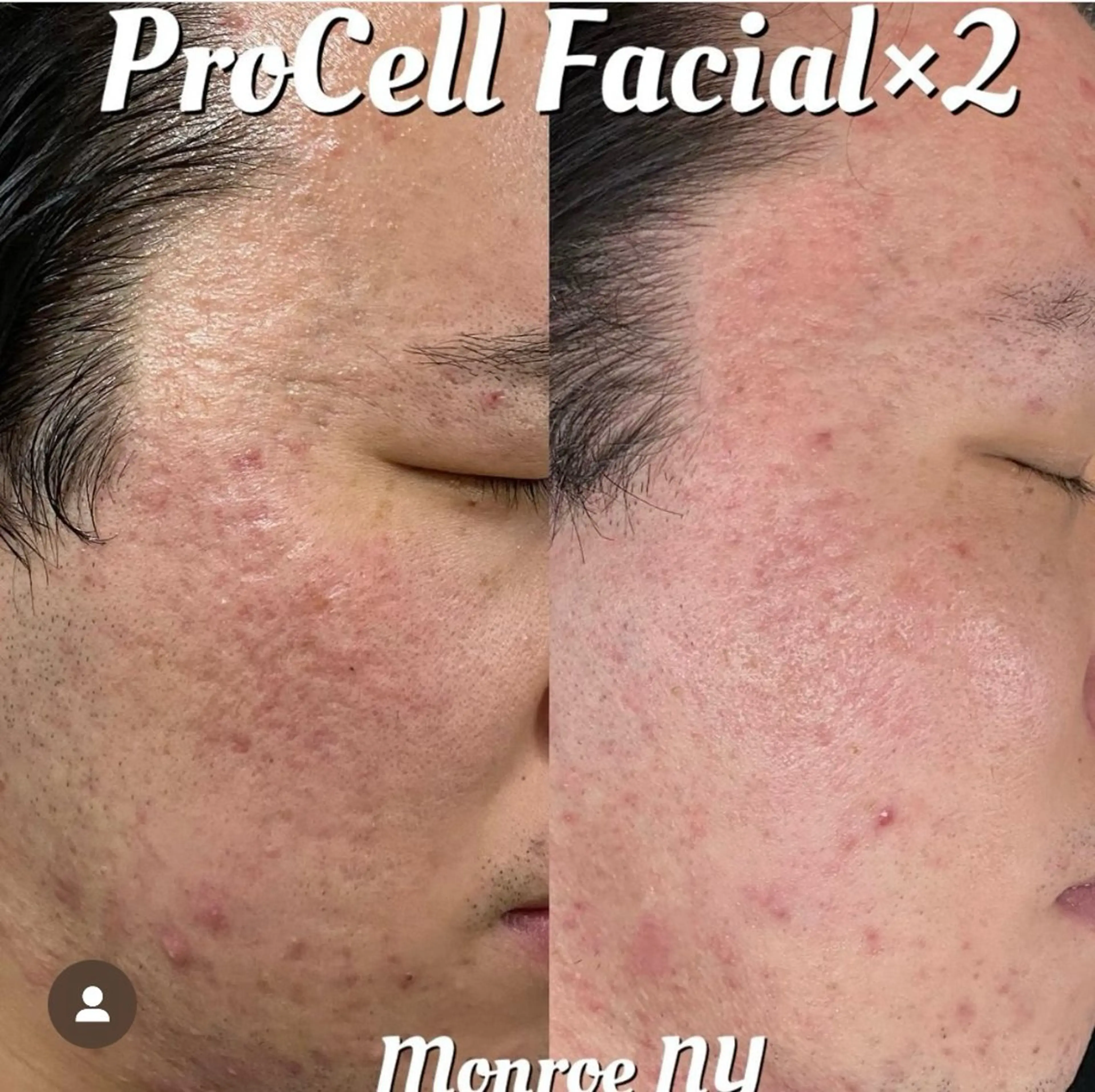 Blooming所属・LOUISE. ／肌質・頭皮のエステ・リラクイメージ