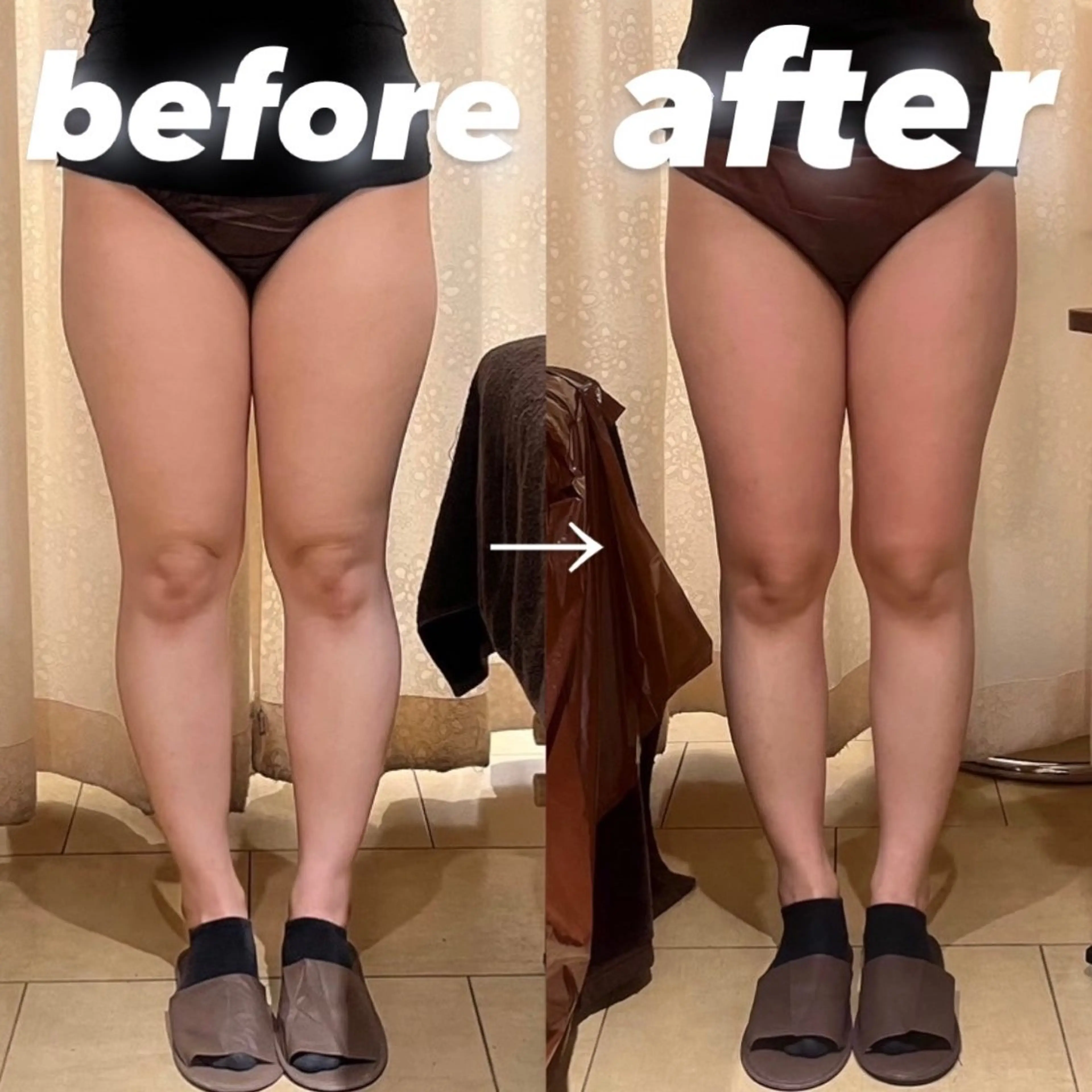 BeauL銀座 村浜友菜🤍のエステ・リラクイメージ