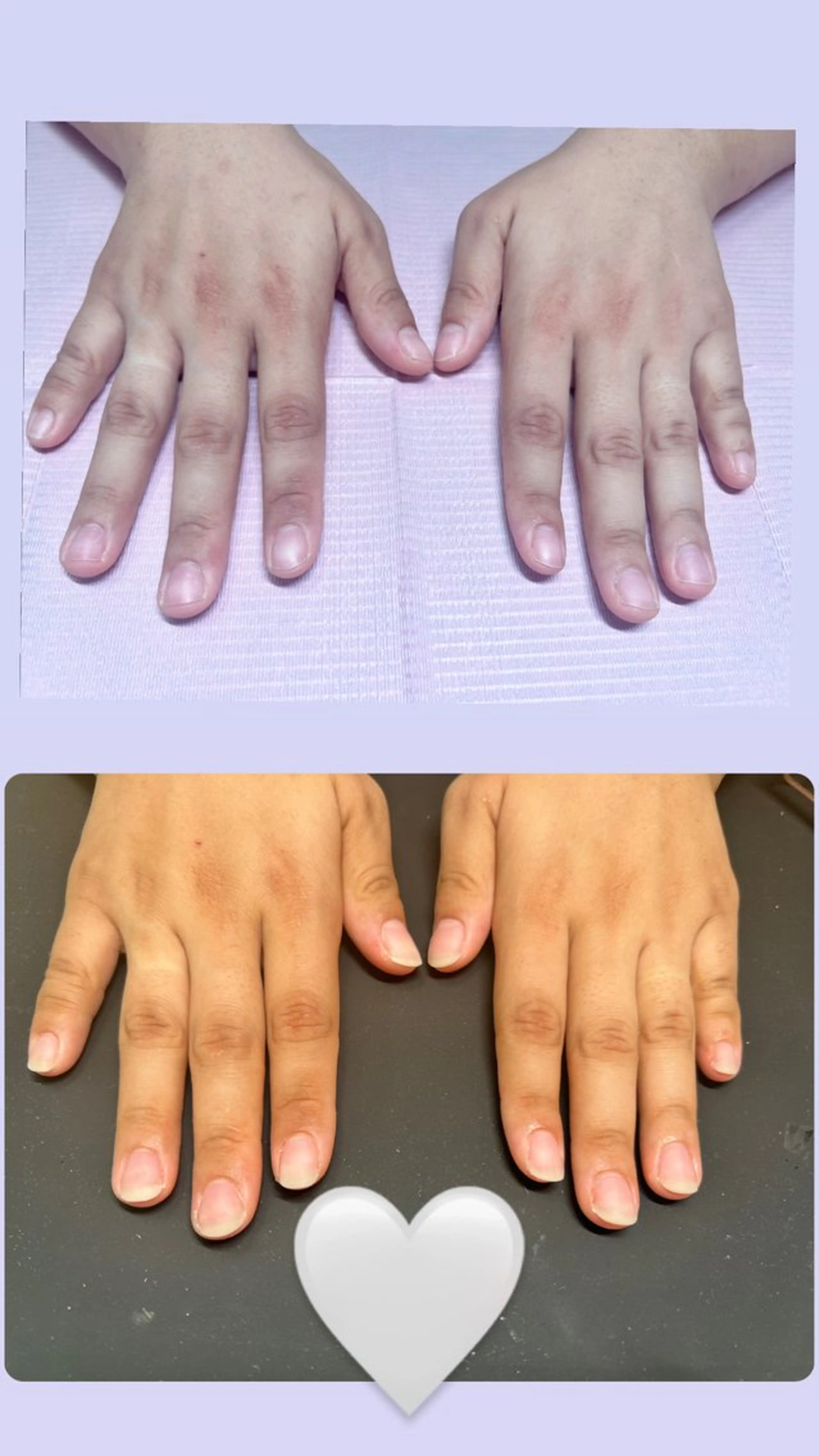 メンズ ネイル 爪ケア/深爪 自爪育成 🐰えむのネイルデザイン