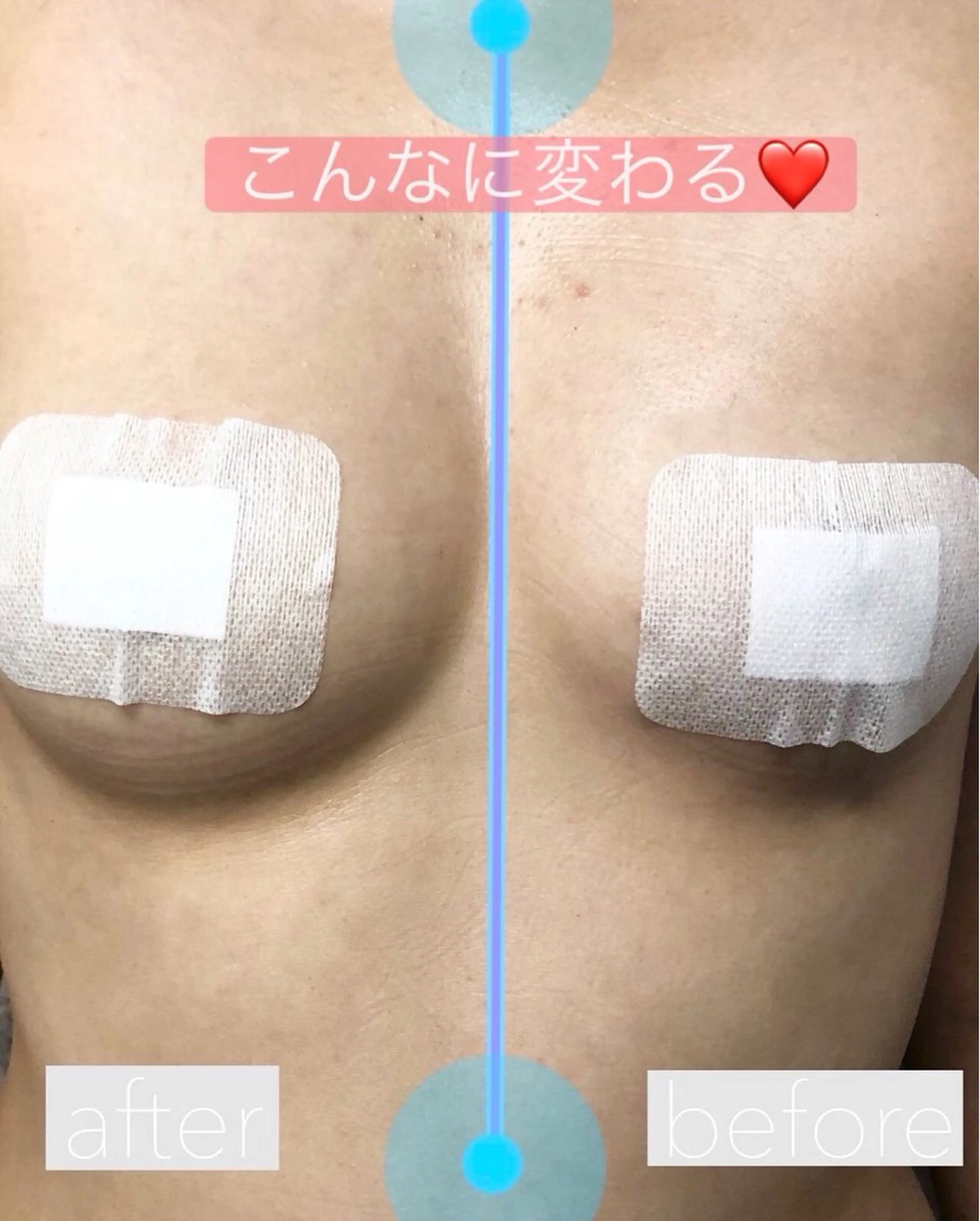 エステ バストアップ特化/デ トックス/小顔/脱毛のエステ・リラクイメージ