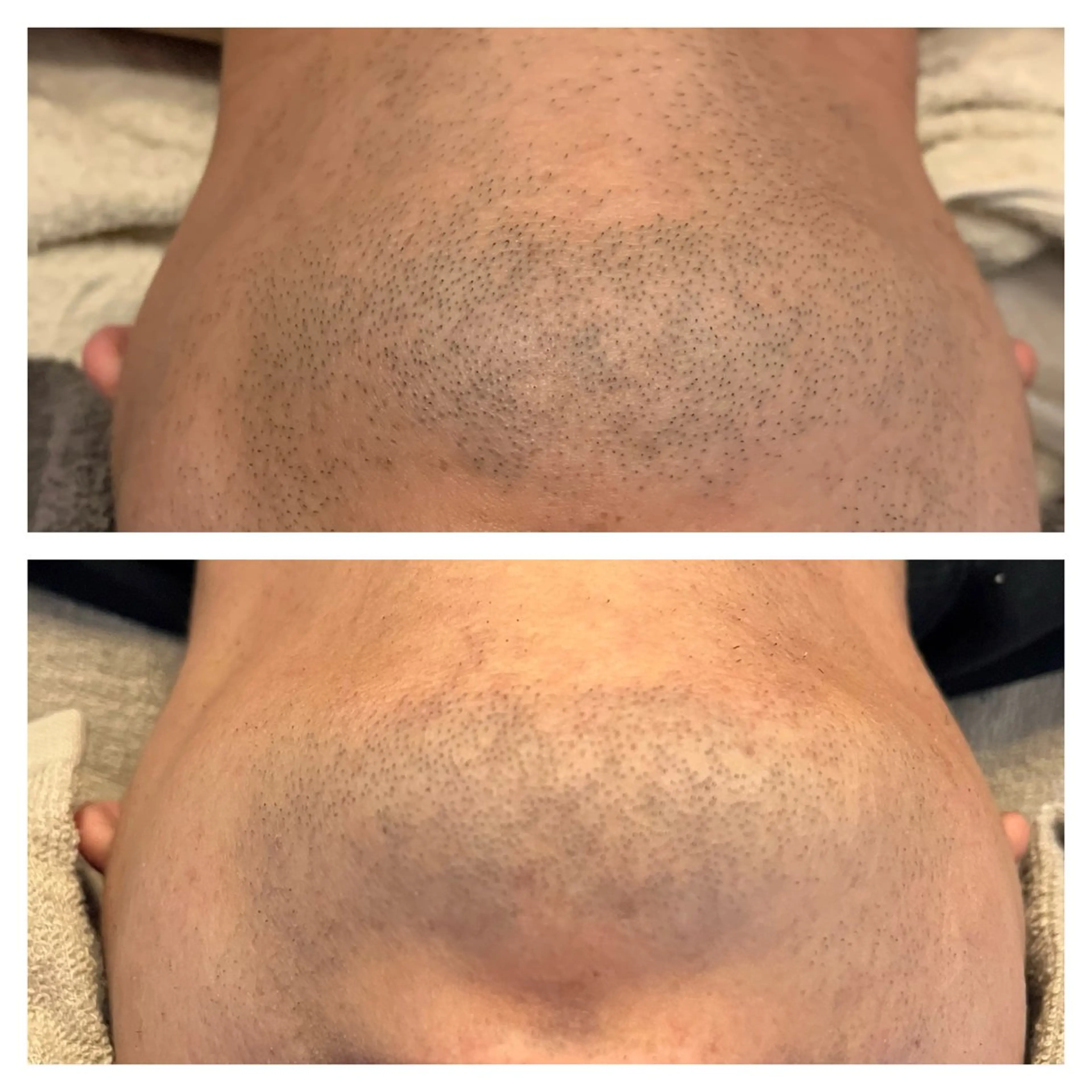 メンズ 花田 亜由美のマツエク・マツパデザイン