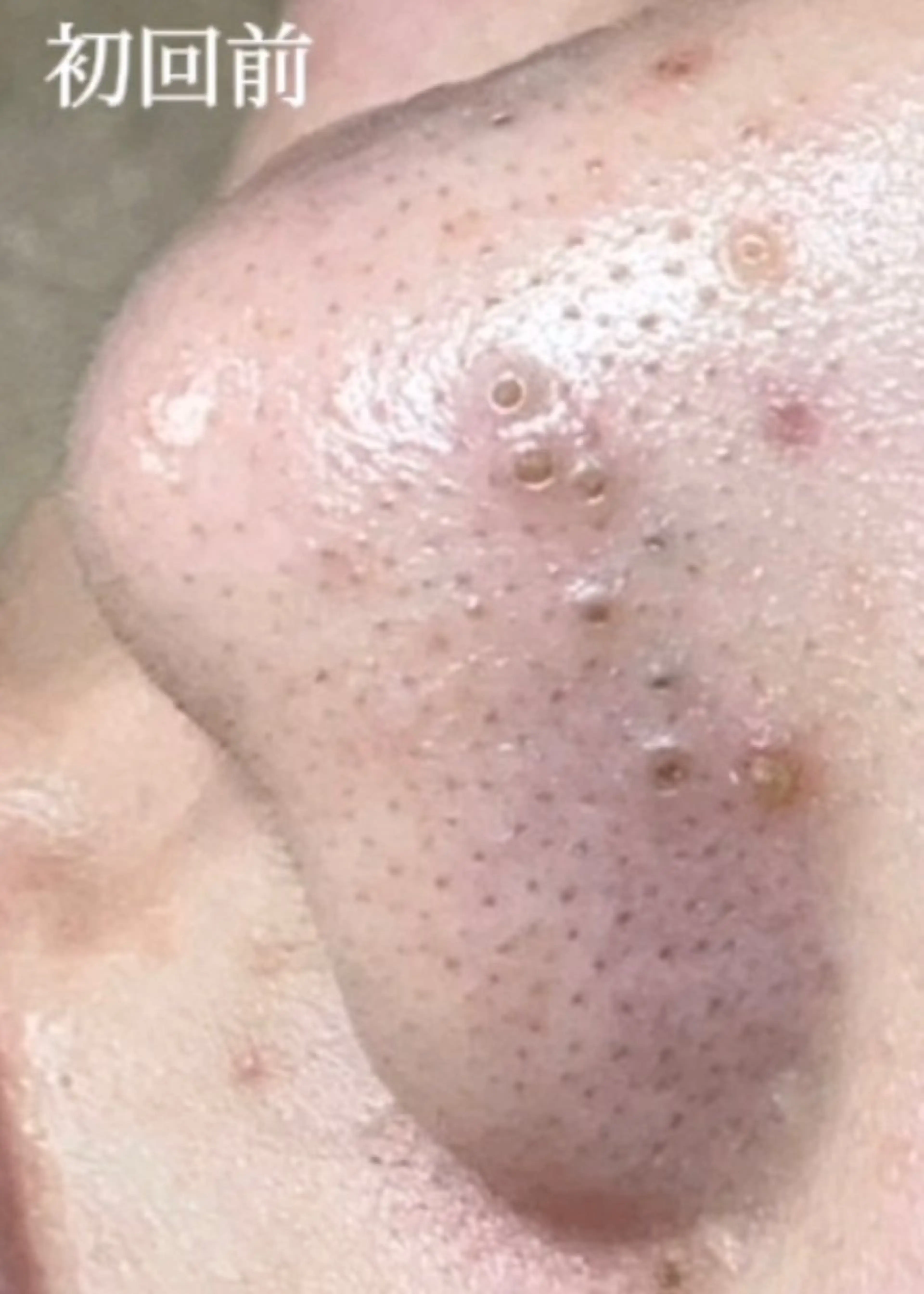 毛穴肌質ケアサロン Yourmeユアミーのエステ・リラクイメージ