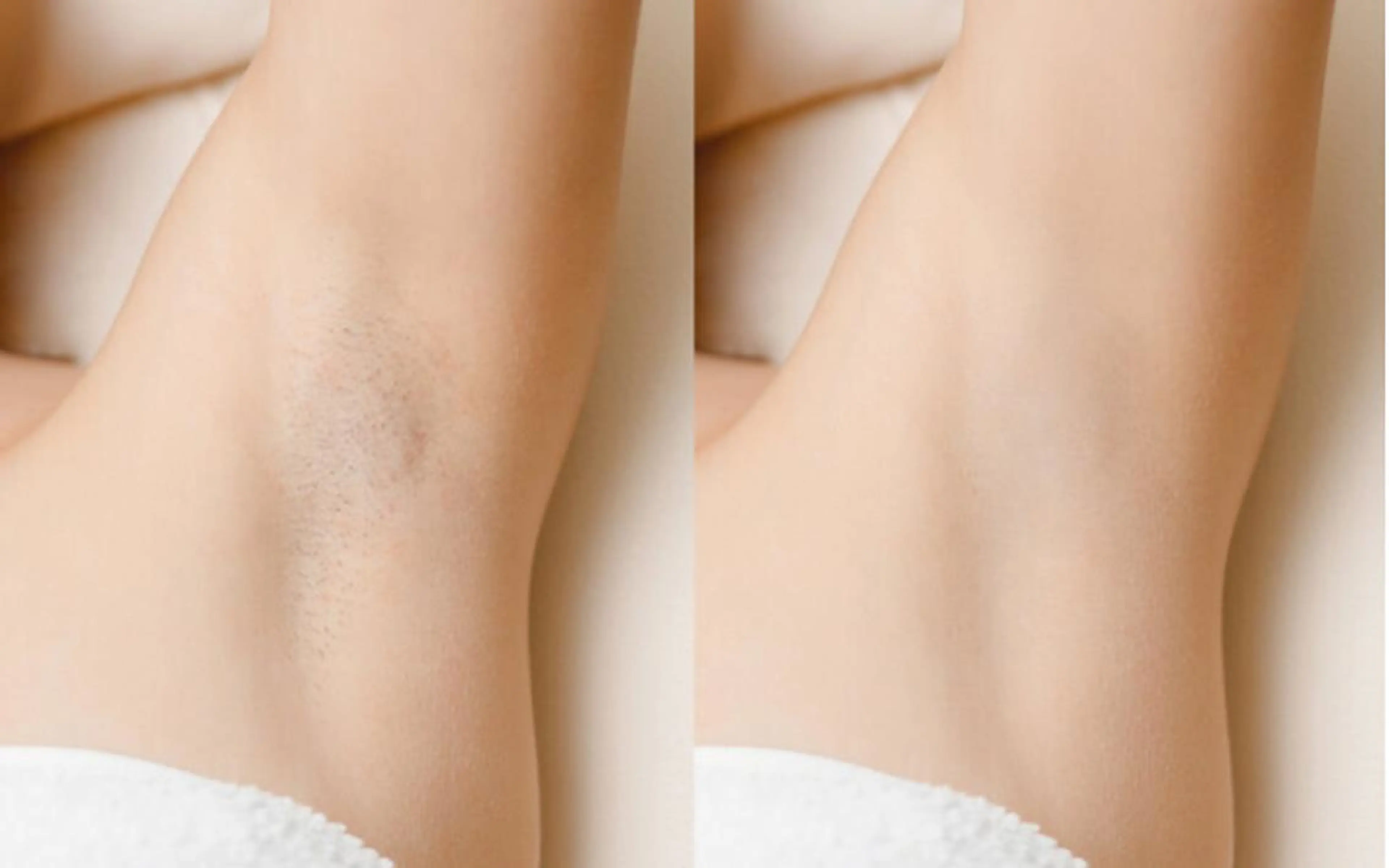 脱毛 美肌脱毛サロン 琥珀所属・トータルビューティー 琥珀のエステ・リラクイメージ