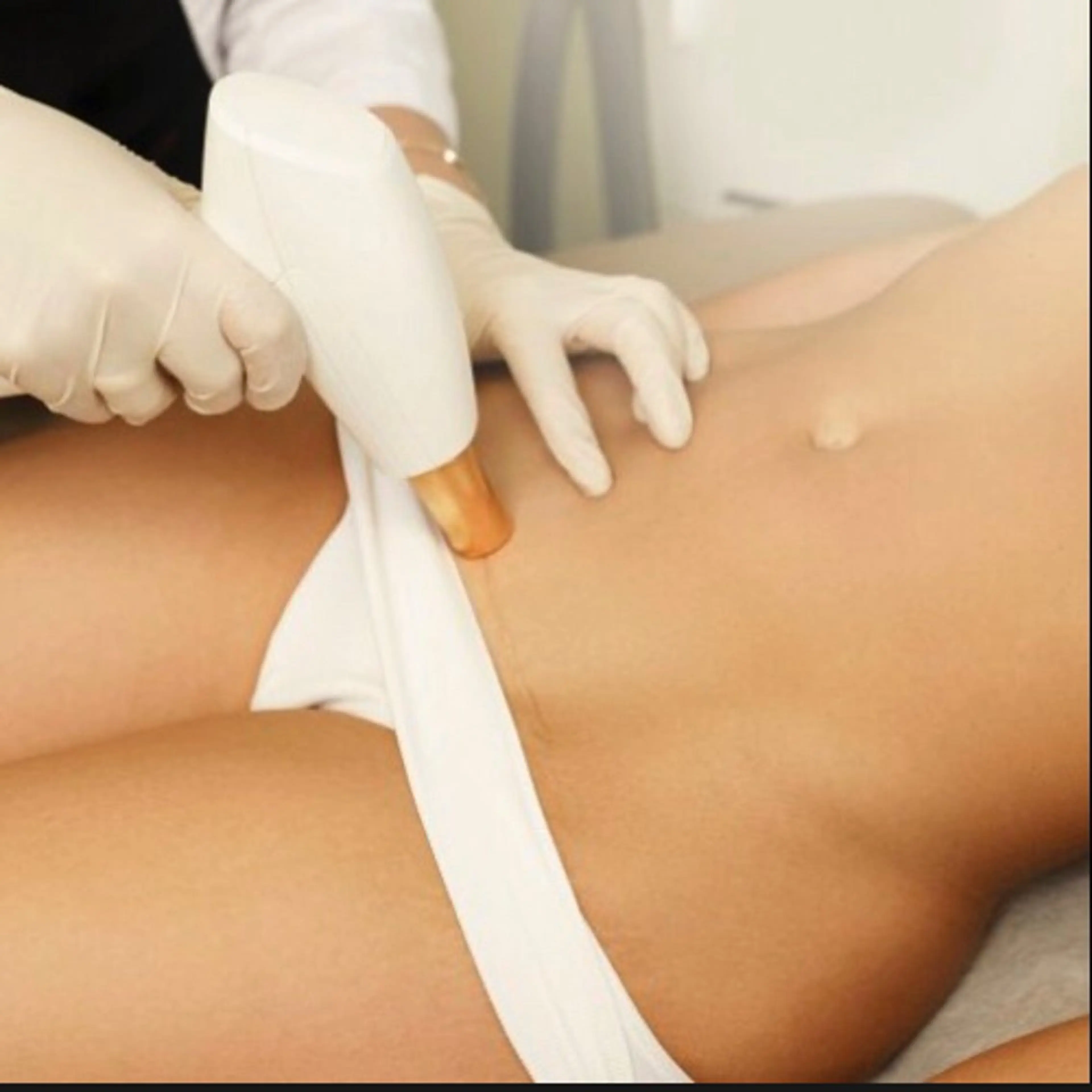 【短期間で完了する】VIO脱毛1回の写真