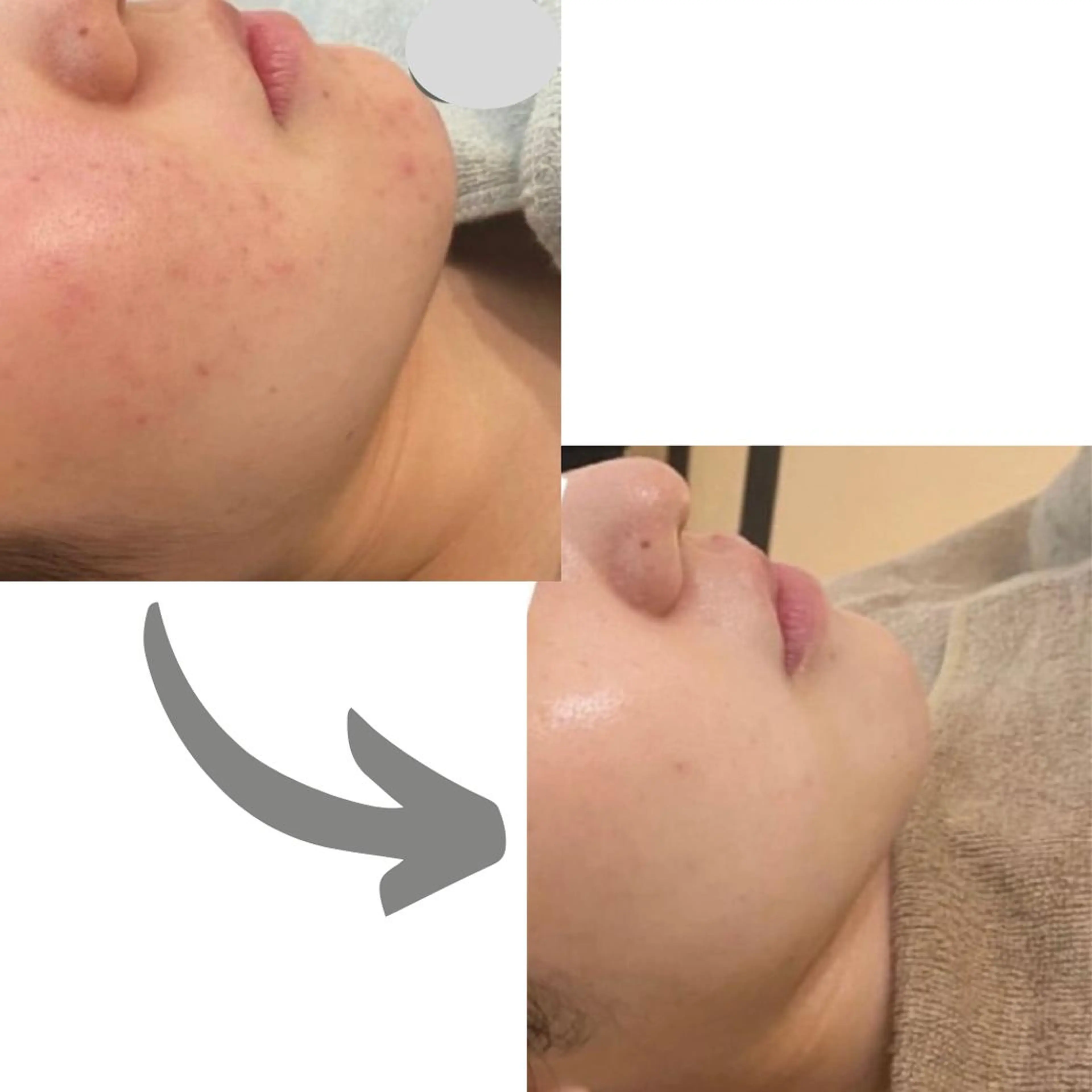 エステ aimee　肌質改善サロン【アイミー】所属・肌質改善サロン aimee｜アイミーのエステ・リラクイメージ