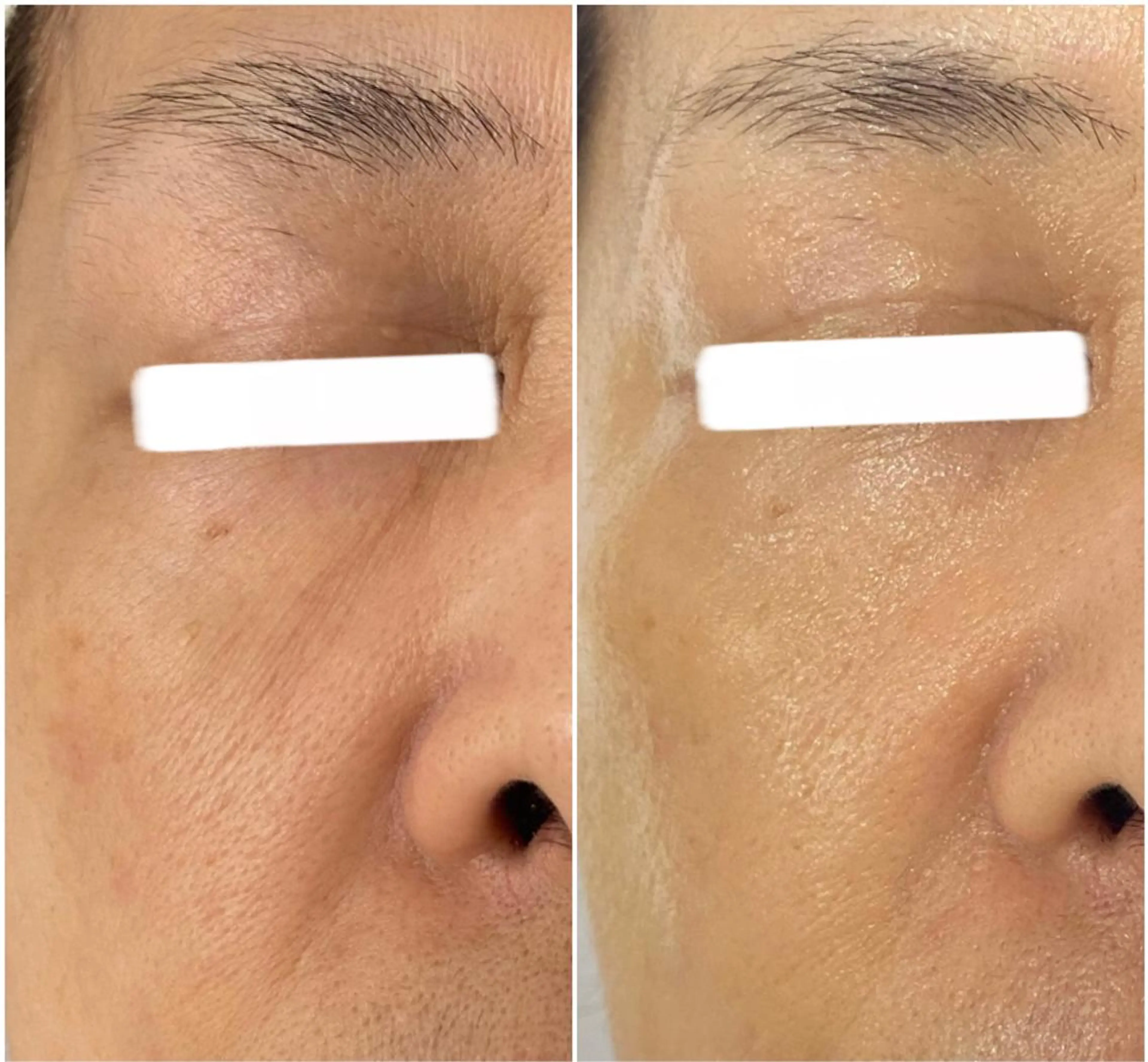 🏳️‍🌈 CHIYAKAのエステ・リラクイメージ