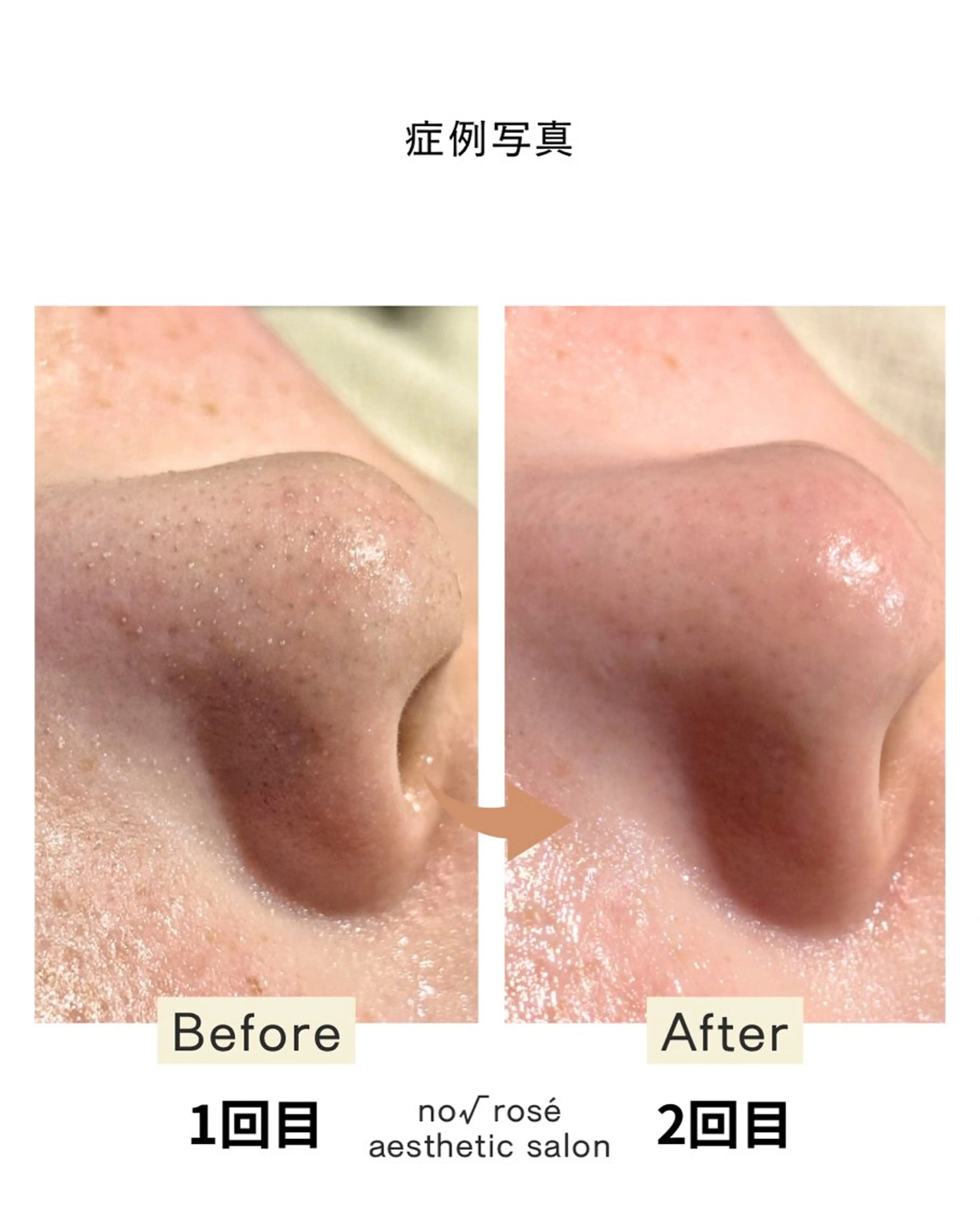 エステ ノールート ロゼのエステ・リラクイメージ