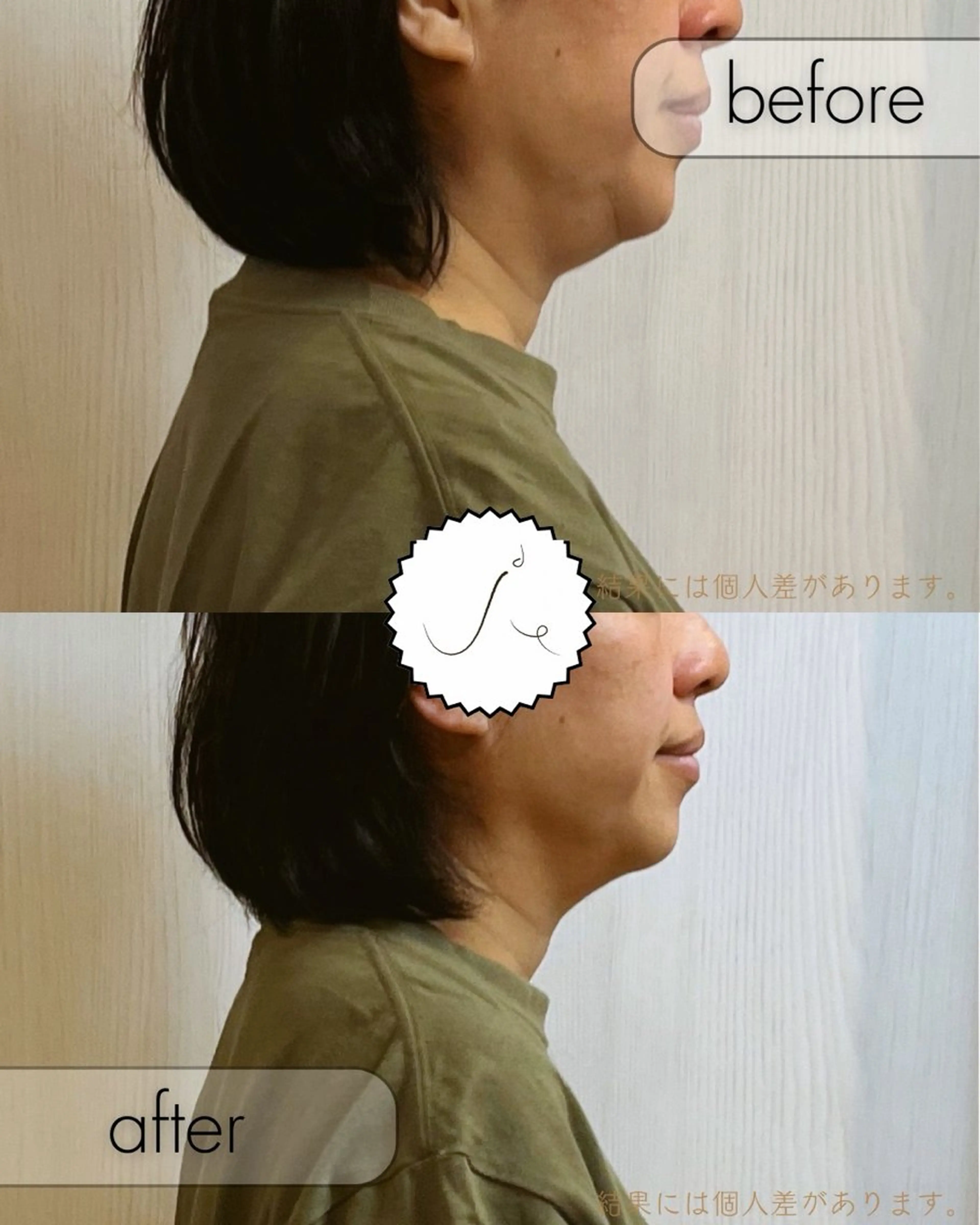 小顔美容矯正勝山式 shiroしろのエステ・リラクイメージ