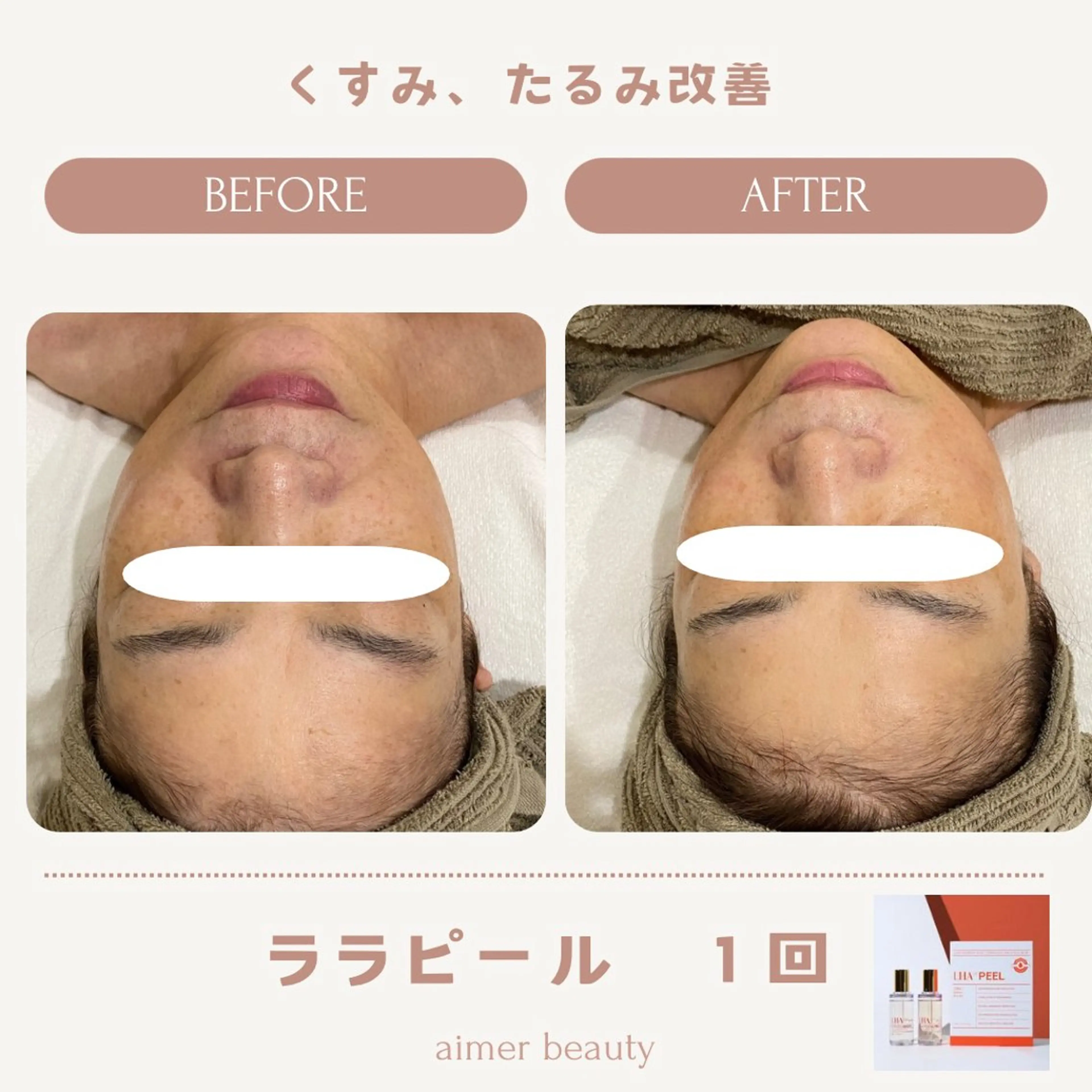 エステ aimer beautyのエステ・リラクイメージ