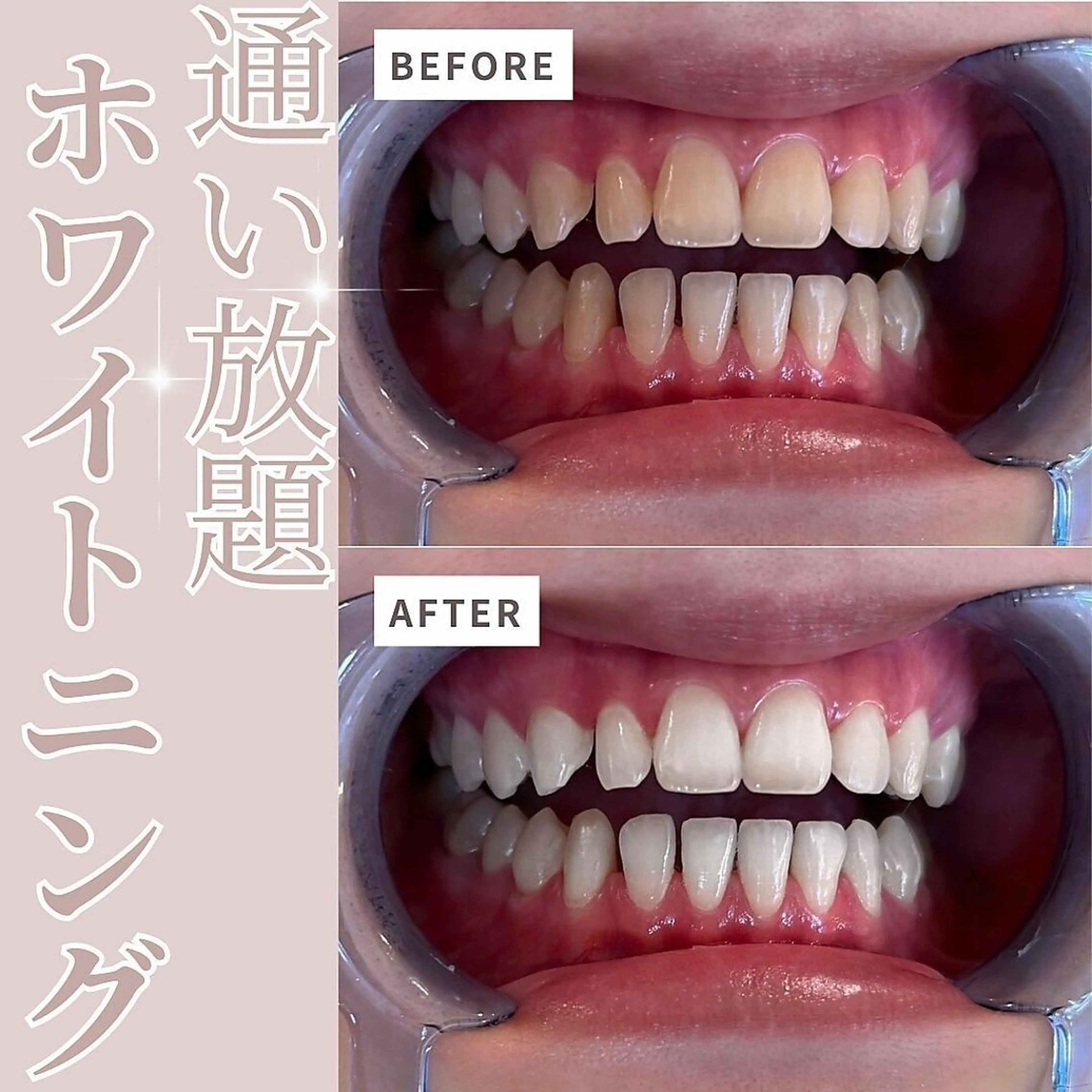 その他 セルフホワイトニング エクシア天神店のその他イメージ