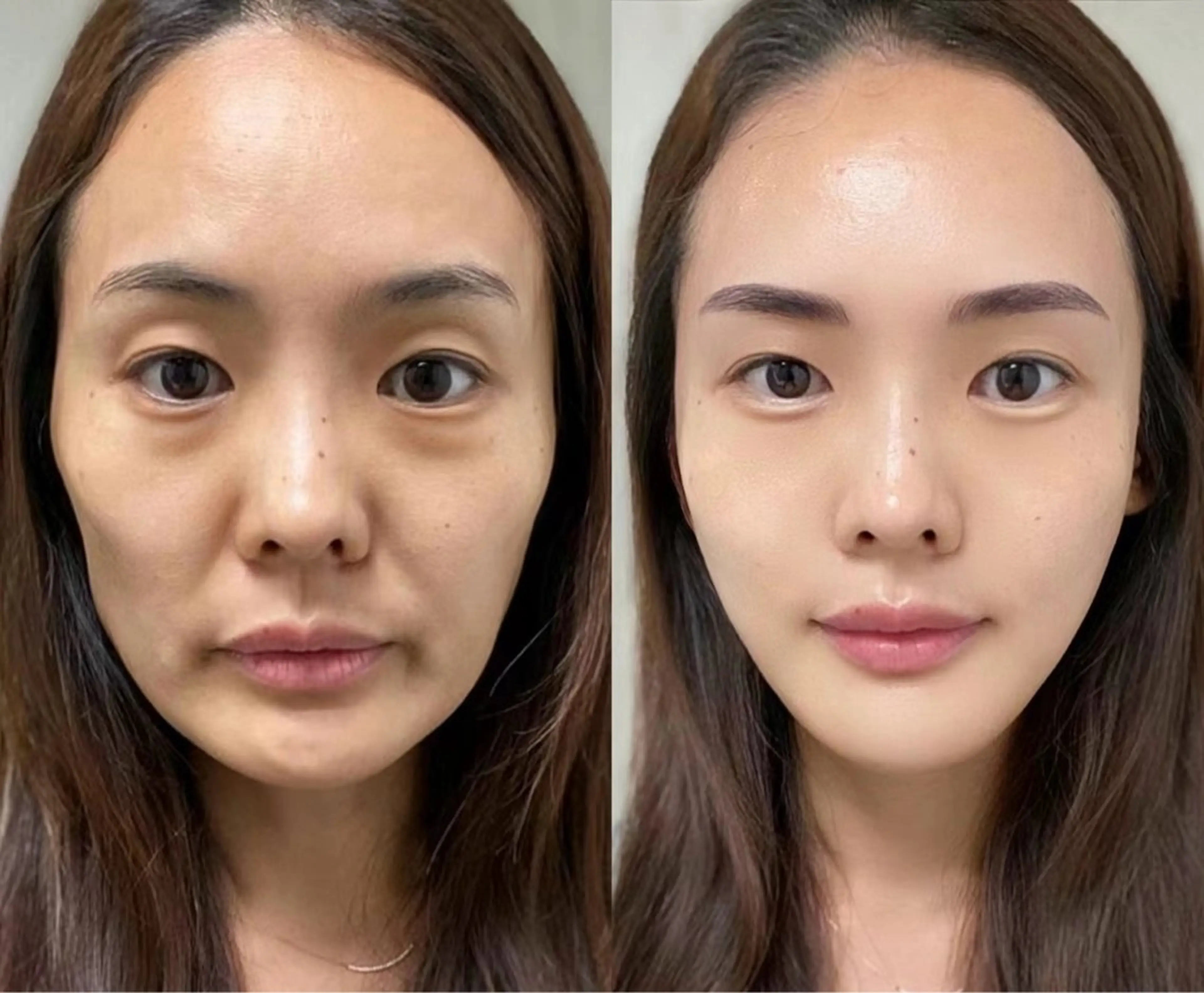 ネイル エステ aliaハイフ&水光ジェットサロン所属・aliaハーブ水光店 エステティシャン募集のエステ・リラクイメージ