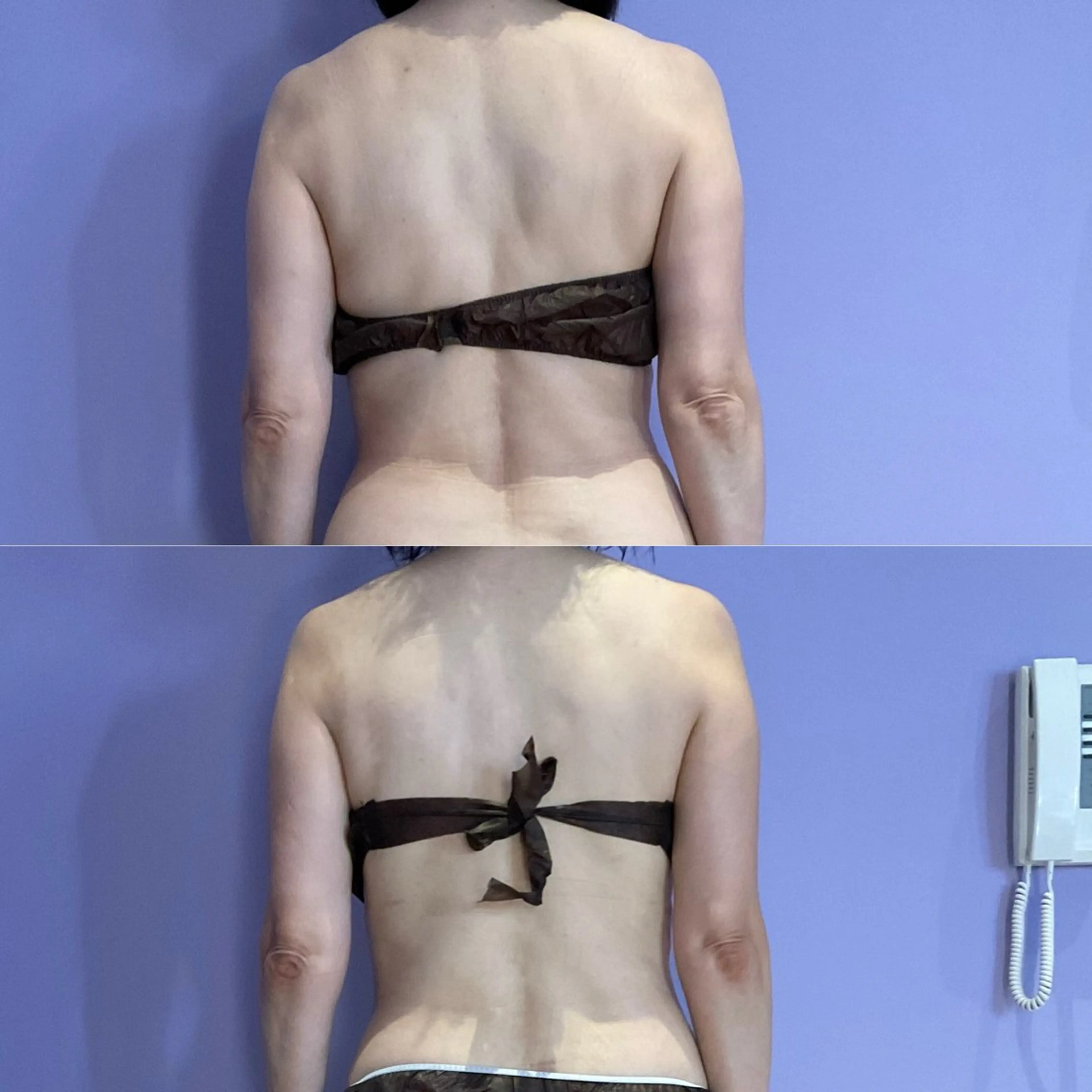 【全員】ミニモ限定！インディバ×インド式エステスーパーデトックス100分の写真