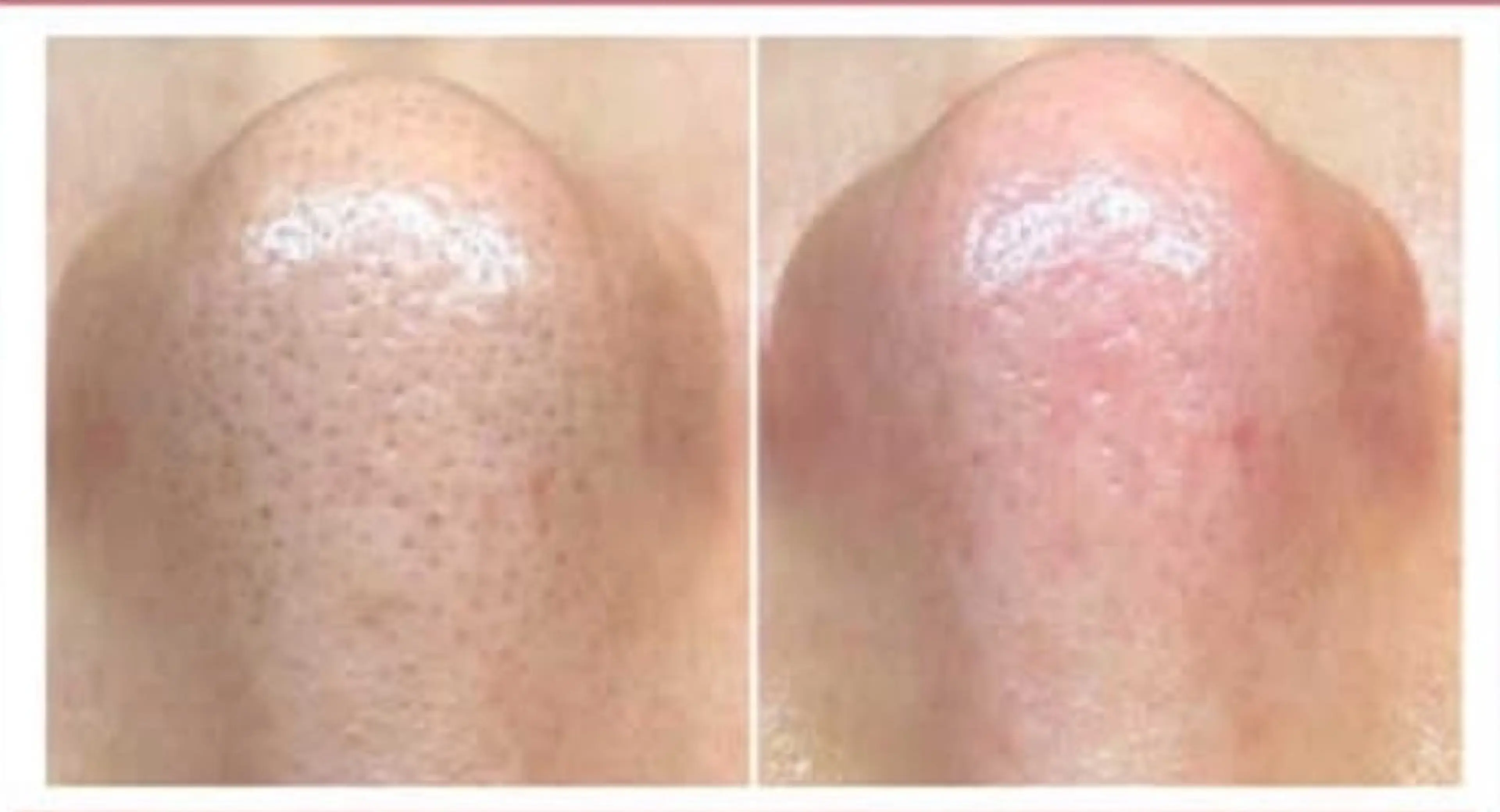 エステ be nail所属・CAMELLIA NAILサロン新松戸のネイルデザイン