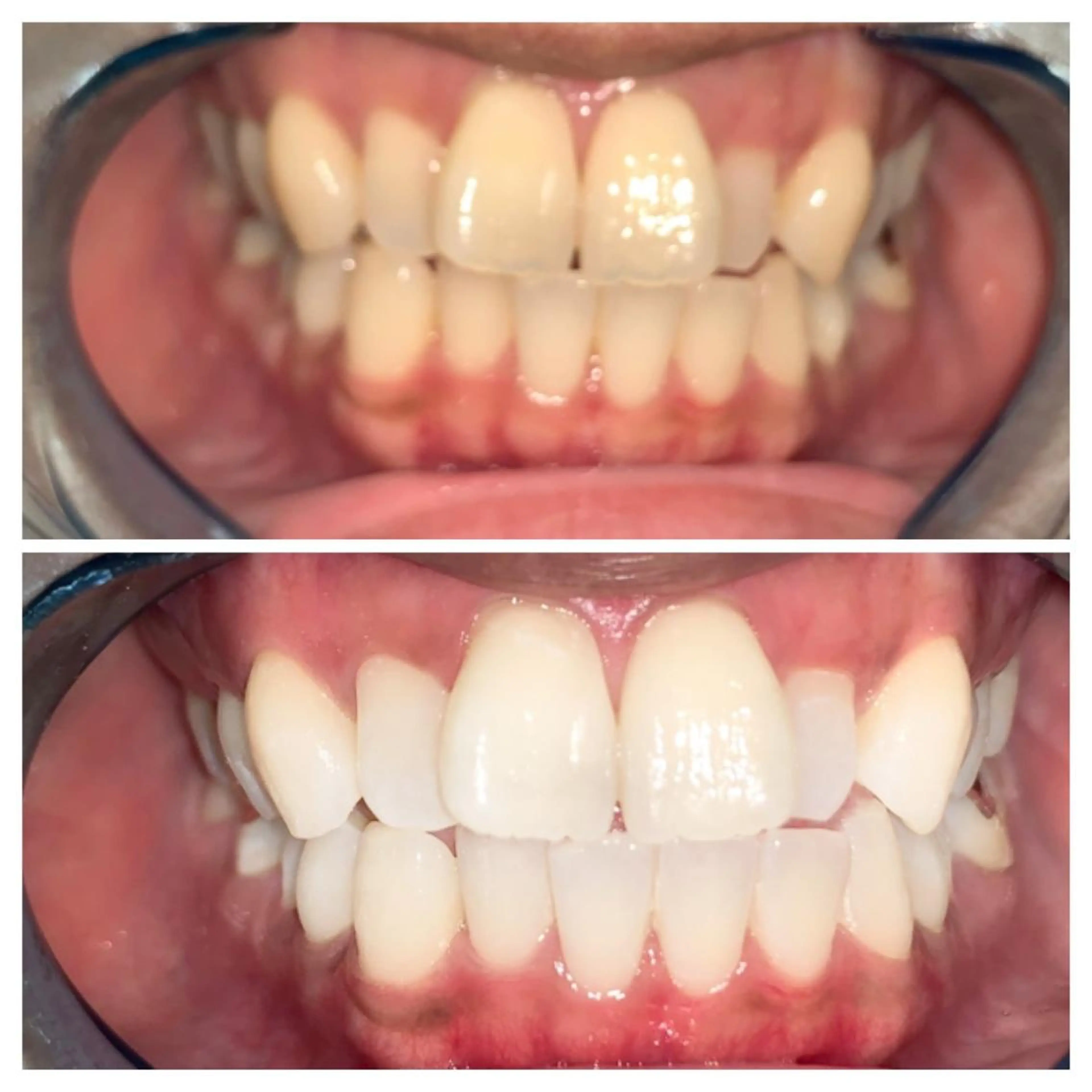 ネイル ヘアアレンジ ロング カラー メンズ マツエク・マツパ アイブロウ キッズ パーマ エステ リラク ライトビューティー 銀座店のエステ・リラクイメージ