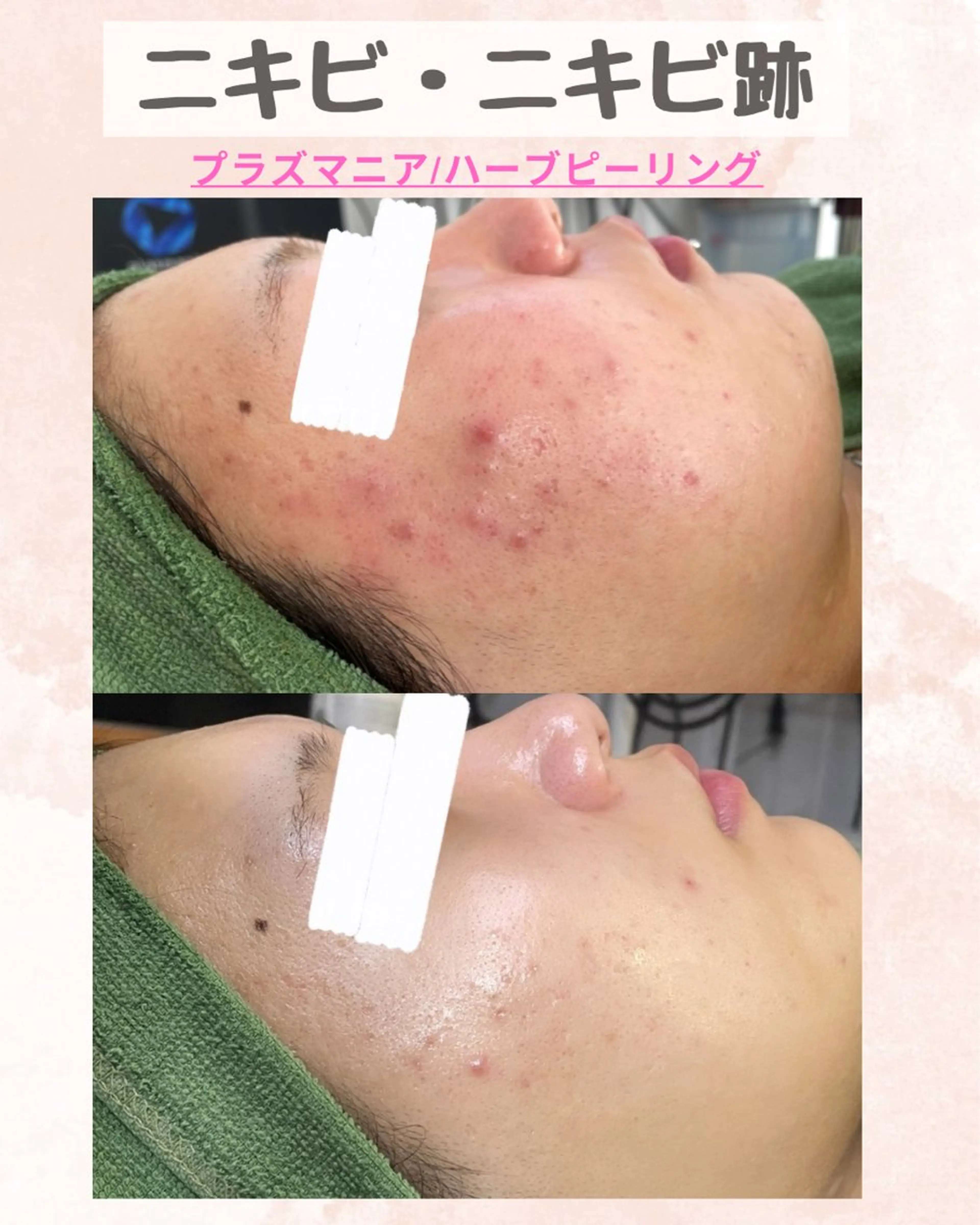 その他 痩身・フェイシャル/if  byOrabriller所属・if byOrab riller【ｲﾌ】のその他イメージ