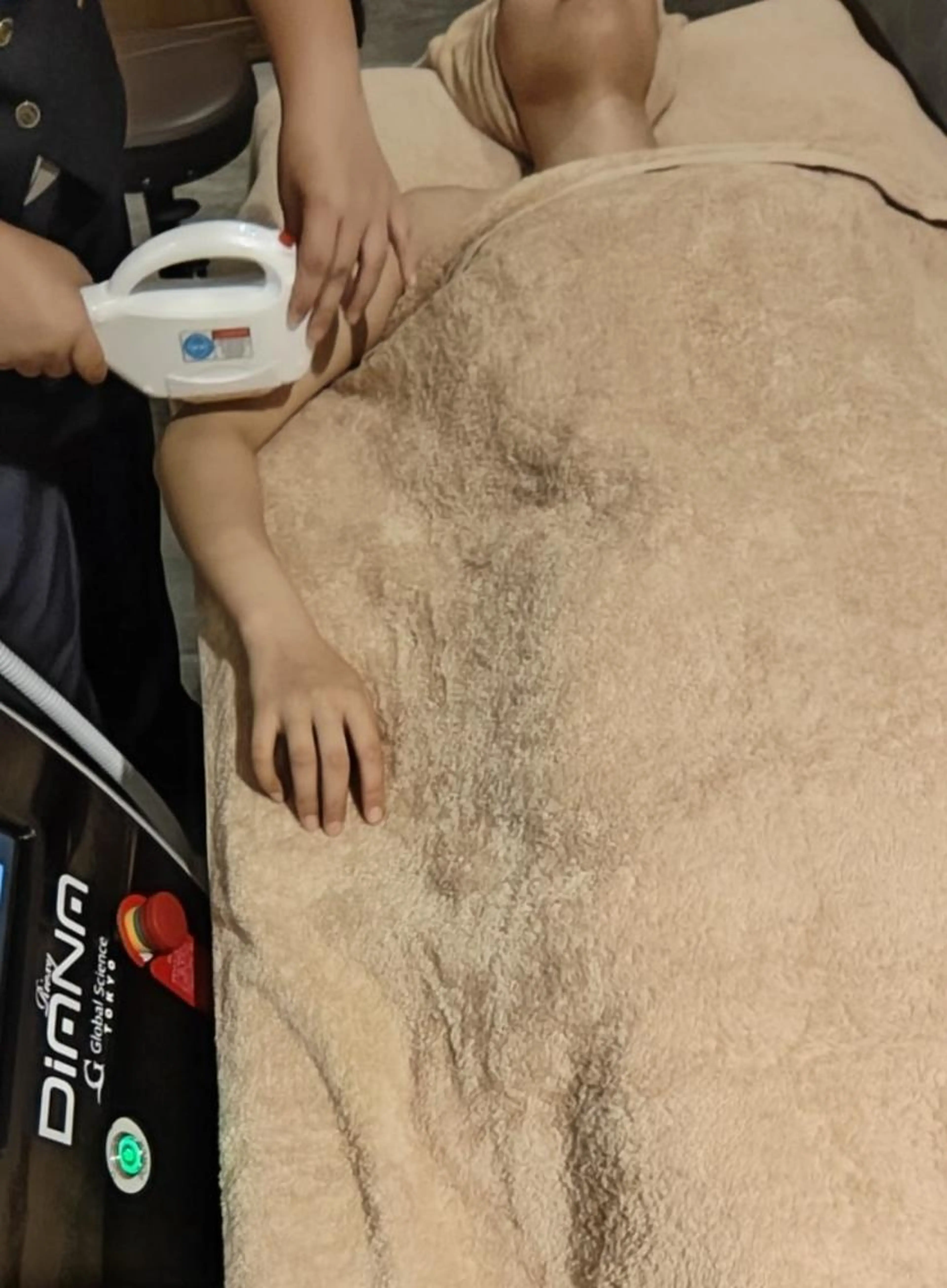 【都度払い】チクチク卒業☆腕・足丸ごと 指毛まで！美肌脱毛　¥6930の写真