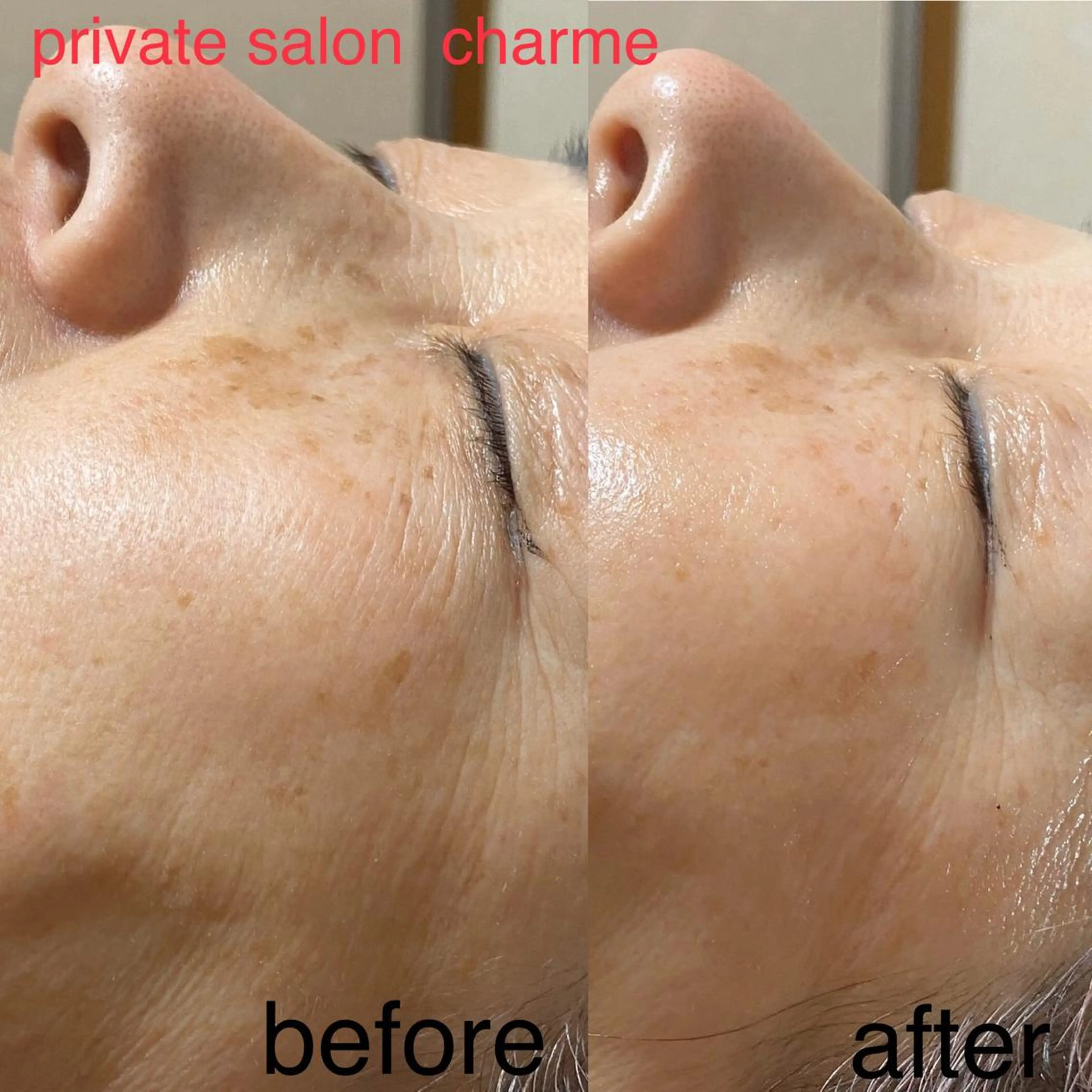 再生美容、ダレノガレ明美さん、田中みな実さん愛用、ハーブマスク体験メニュー！クリスティーナ化粧品ホームケア用マスクお試しの写真