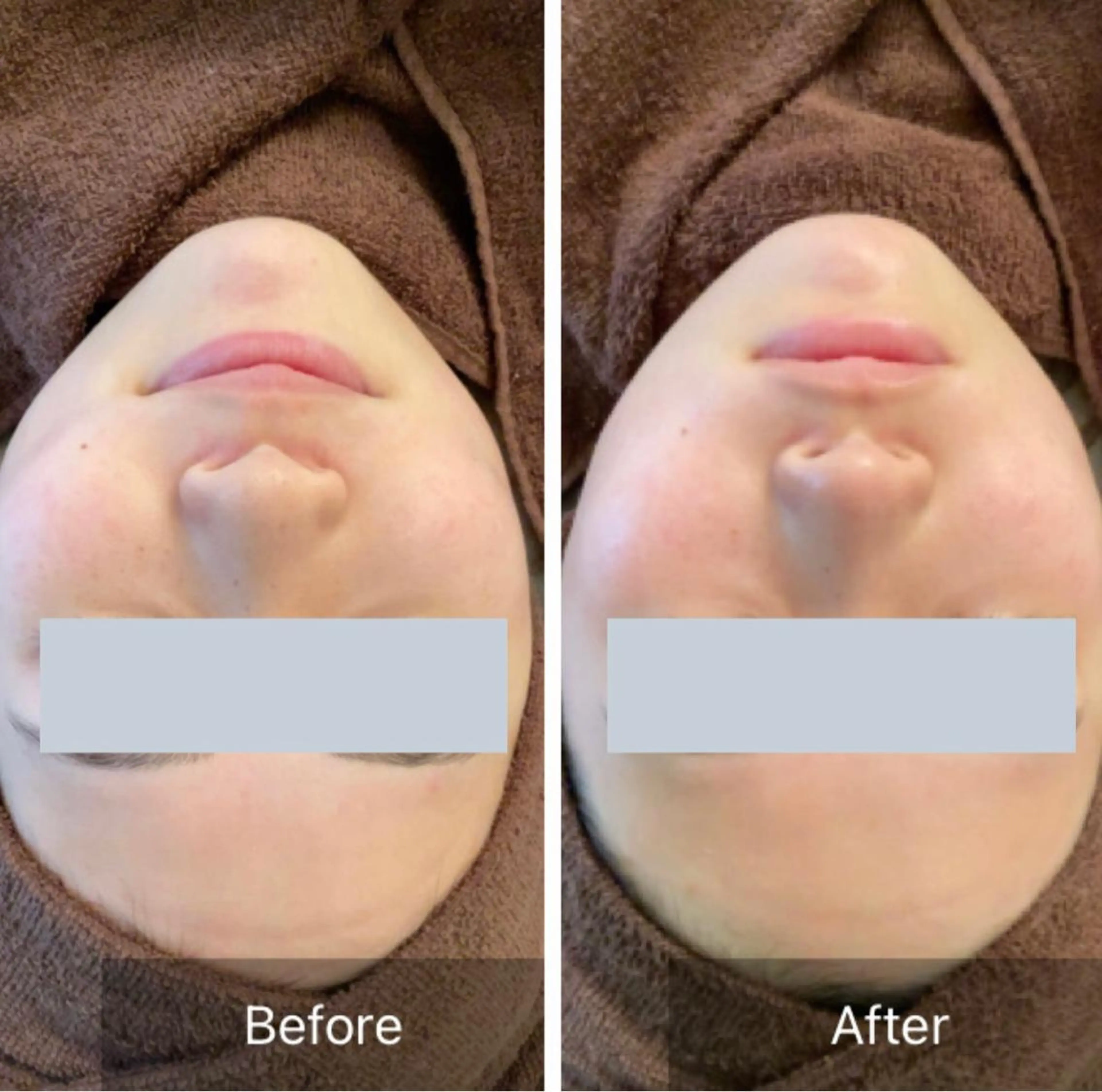 Lumiere despoir所属・Lumiere despoirのエステ・リラクイメージ