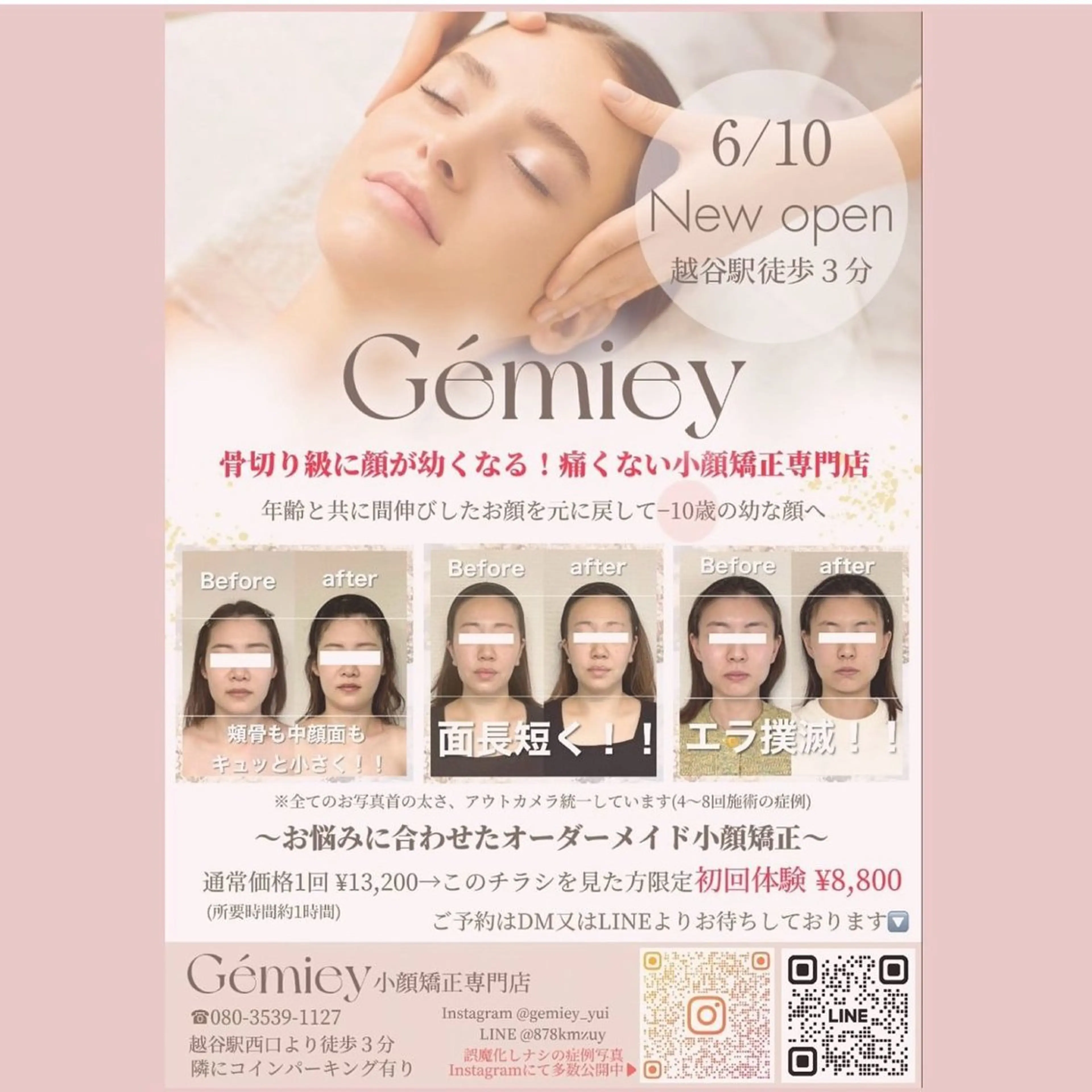 小顔矯正専門店Gémiey所属・越谷駅徒歩３分 小顔専門Gemieyのエステ・リラクイメージ