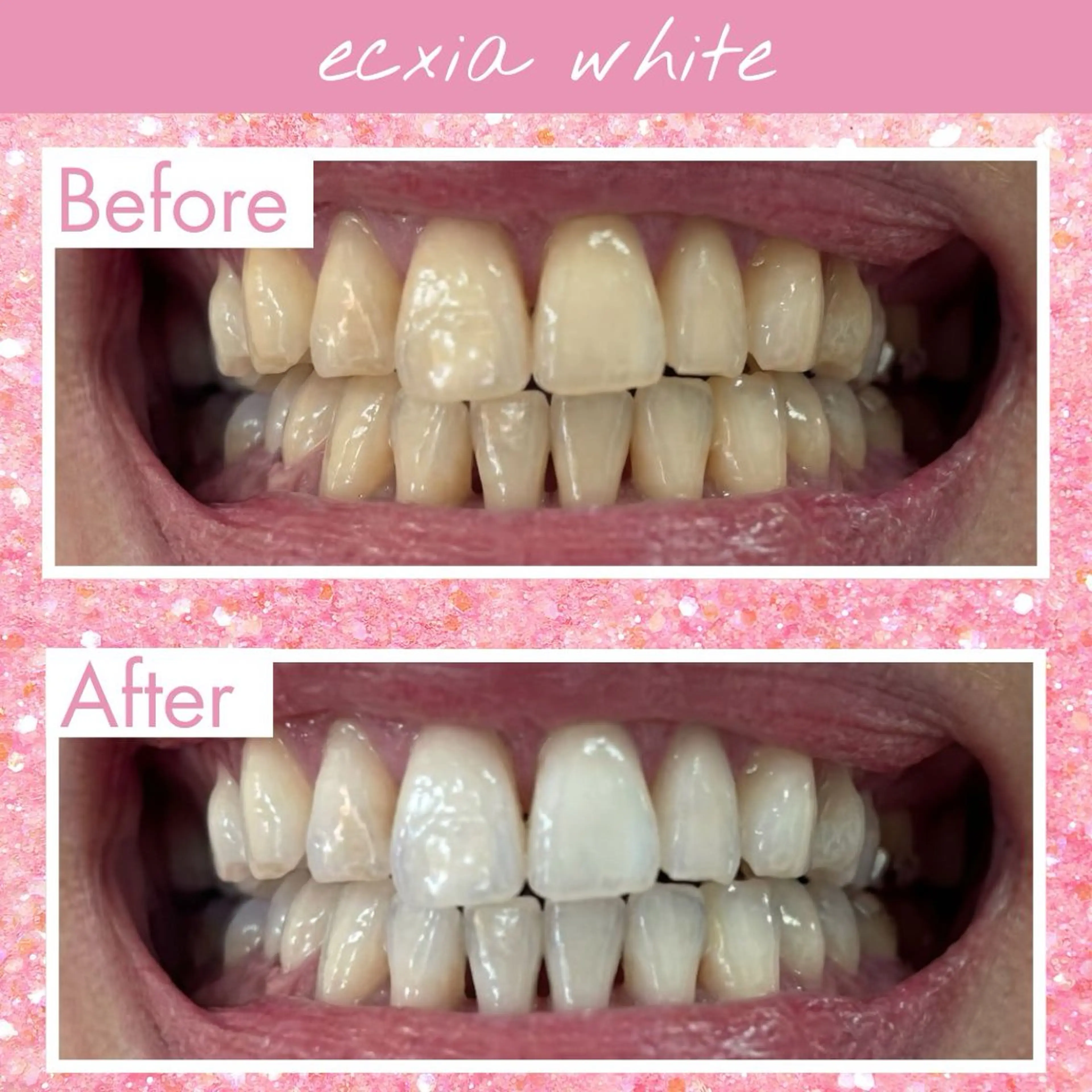 エクシアホワイトニング伊勢店所属・セルフホワイトニング エクシア伊勢店のその他イメージ