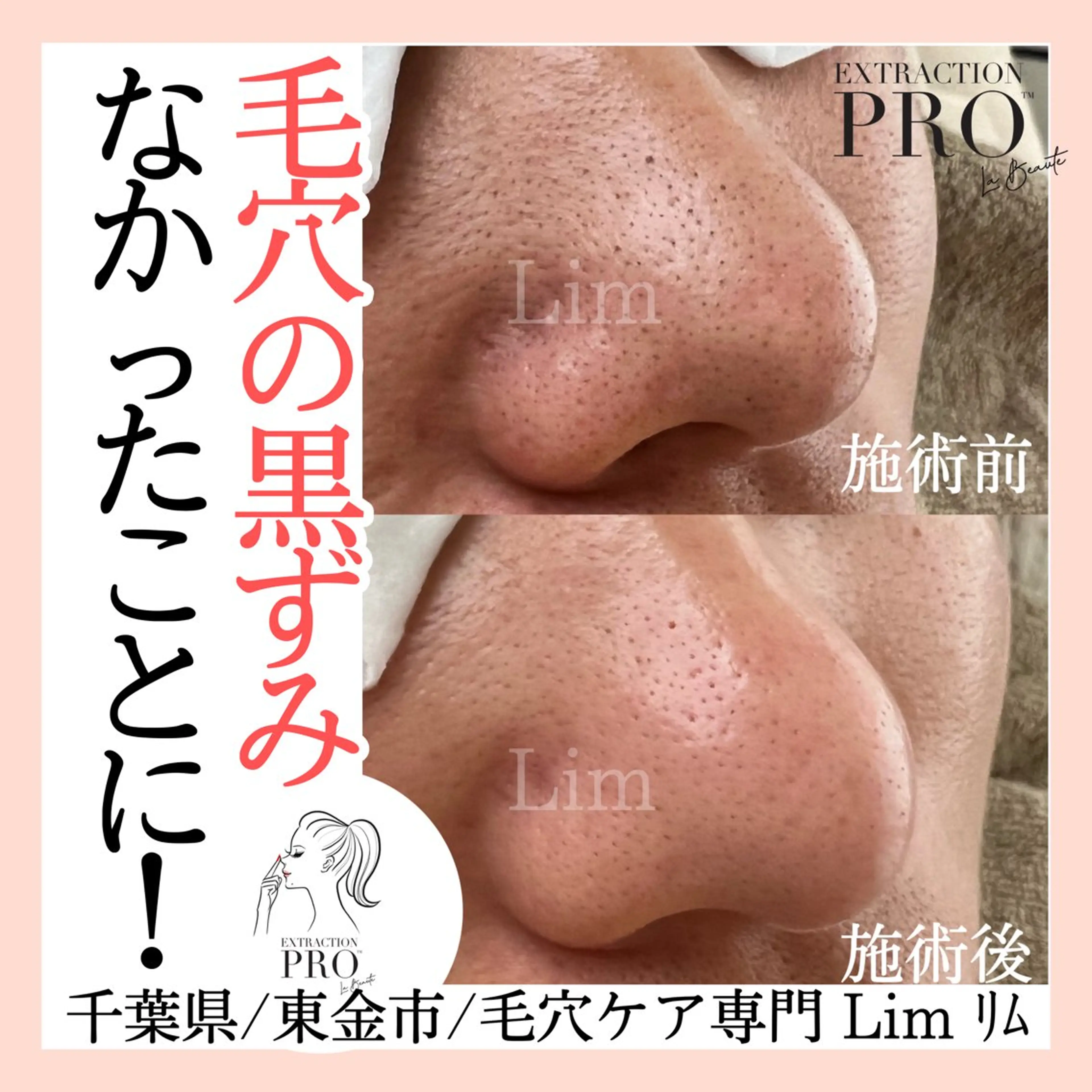 Lim Naomiのマツエク・マツパデザイン