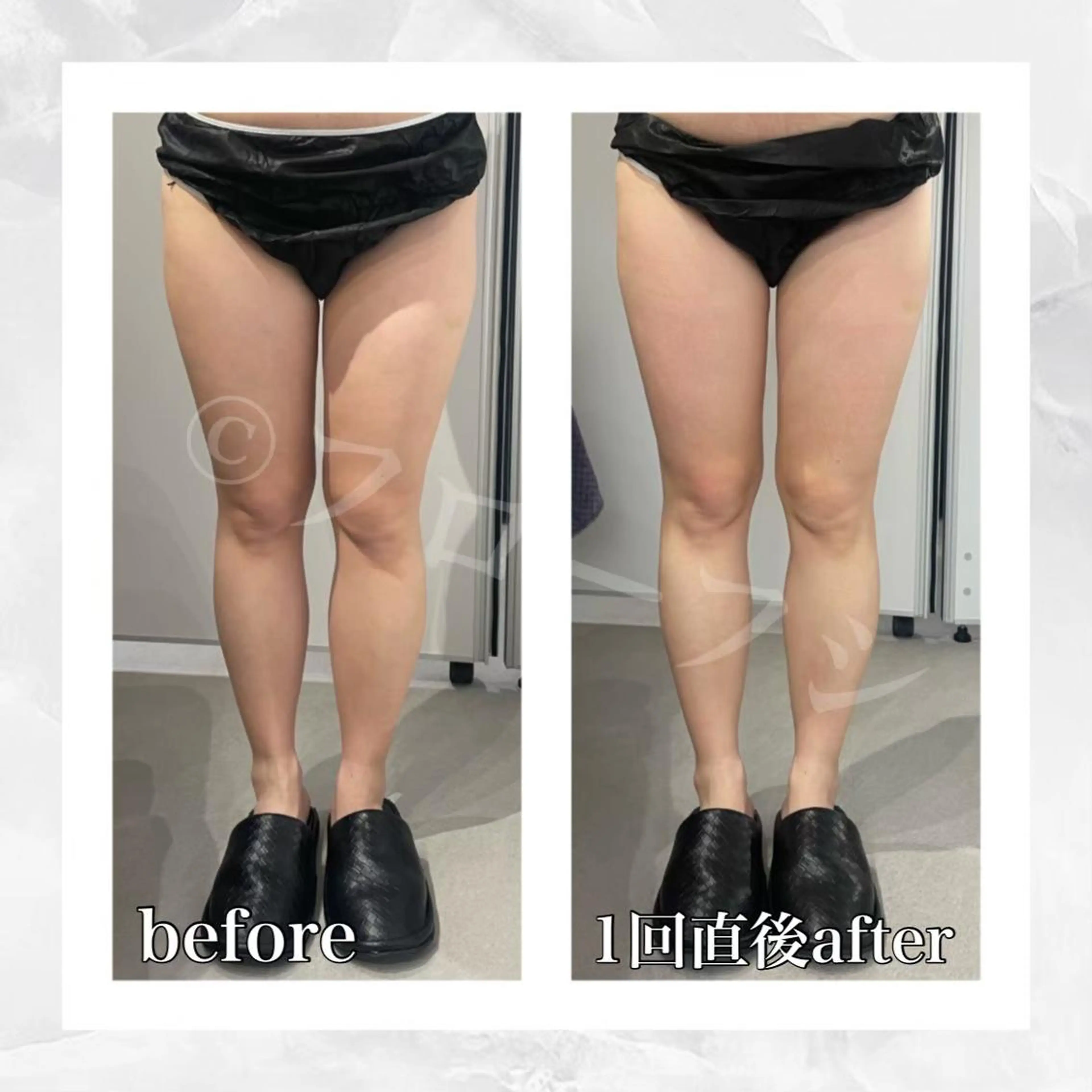 エステ リラク 部分痩せ♥️小顔専門 MIKUのエステ・リラクイメージ