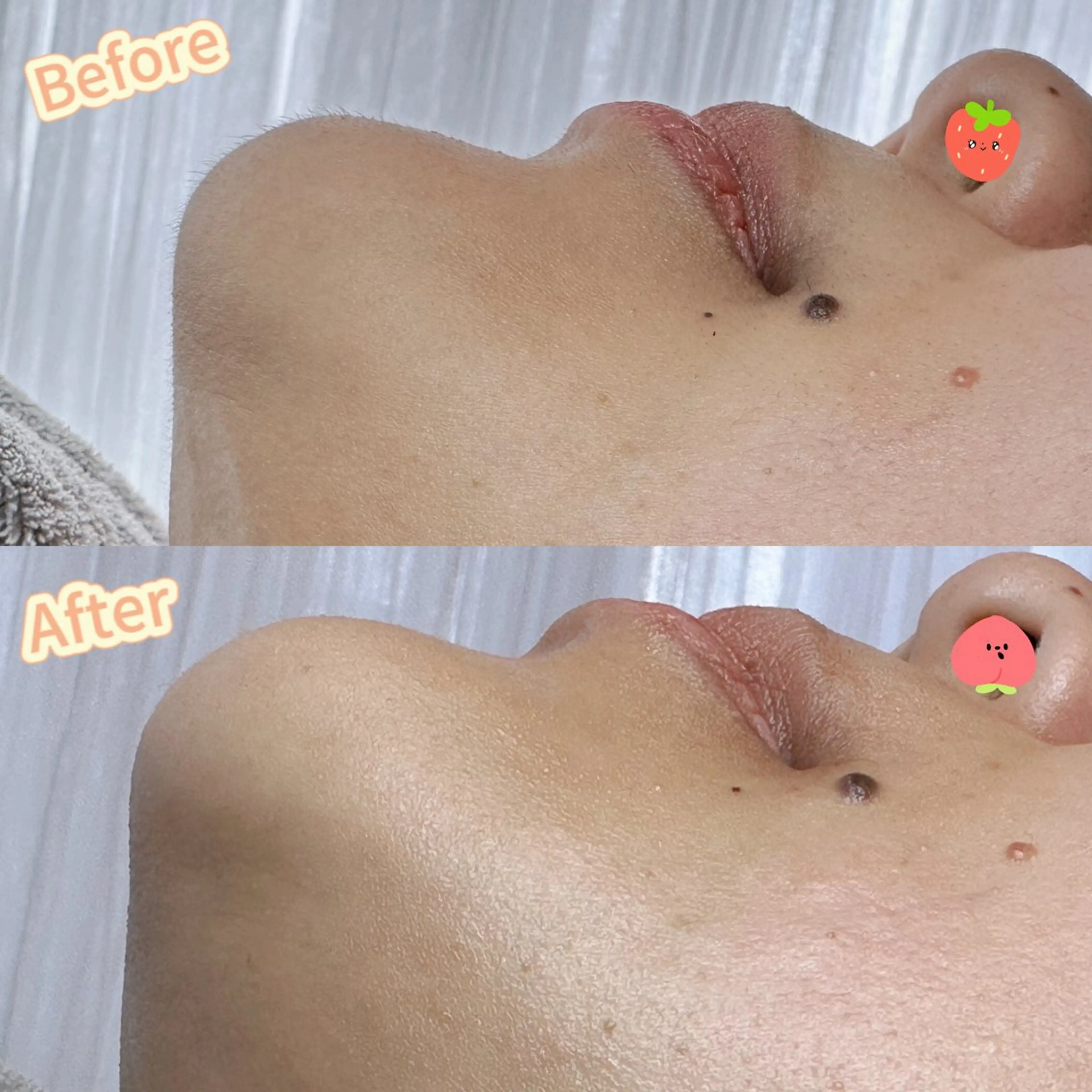 Hit. シュガーリング豊橋のエステ・リラクイメージ