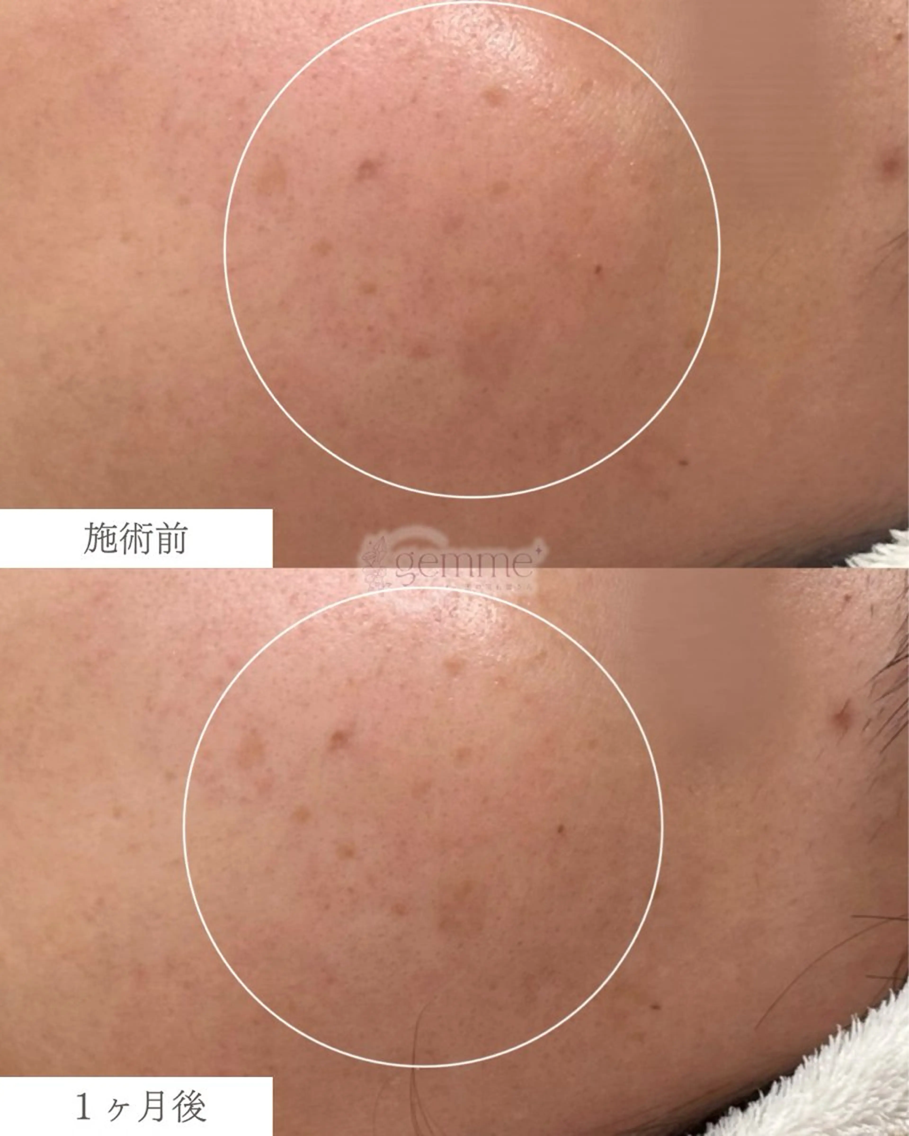 エステ リラク 美の宝石屋さん gemme【ジェム】所属・gemme -ジェム-のエステ・リラクイメージ