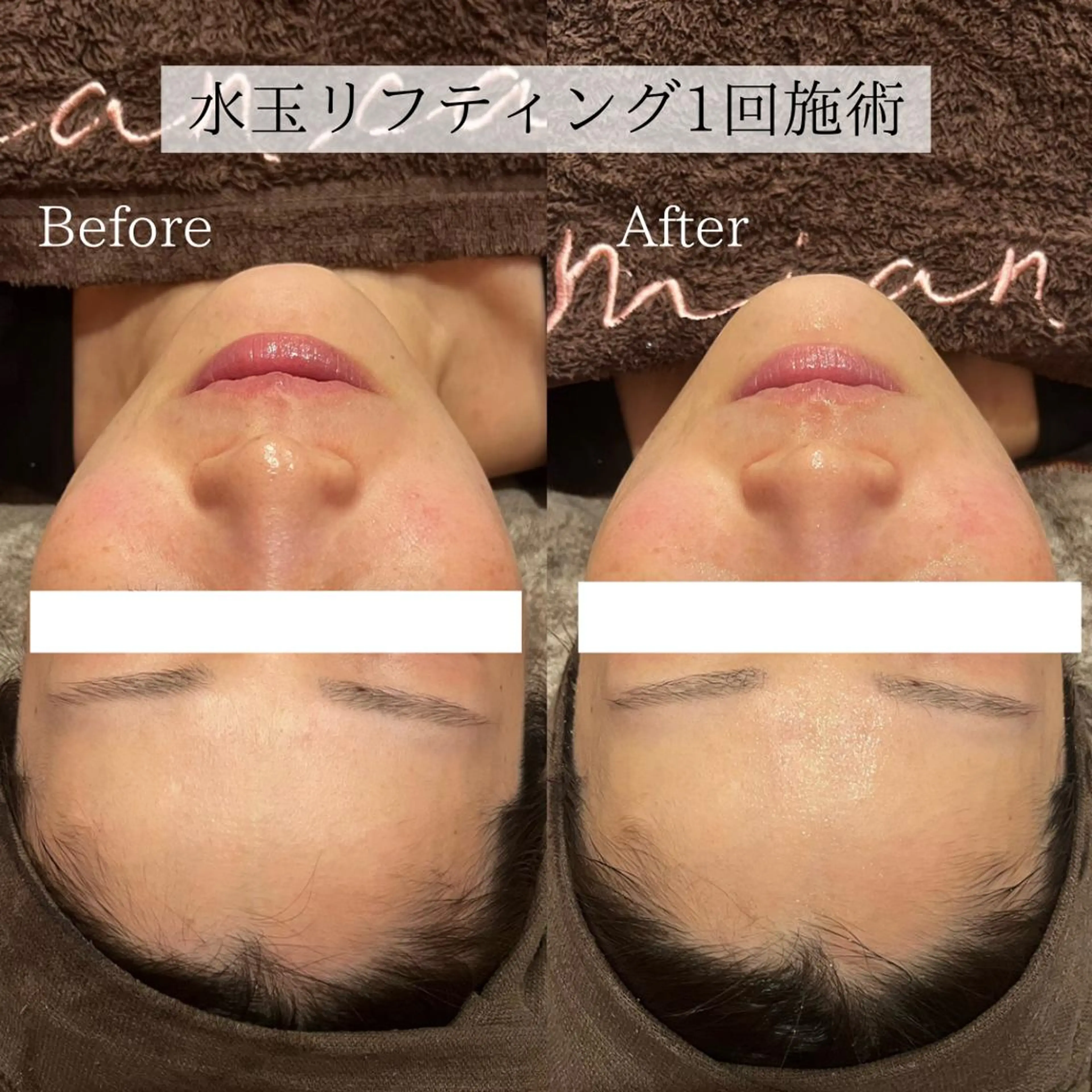 お試し水玉リフティング6分の写真