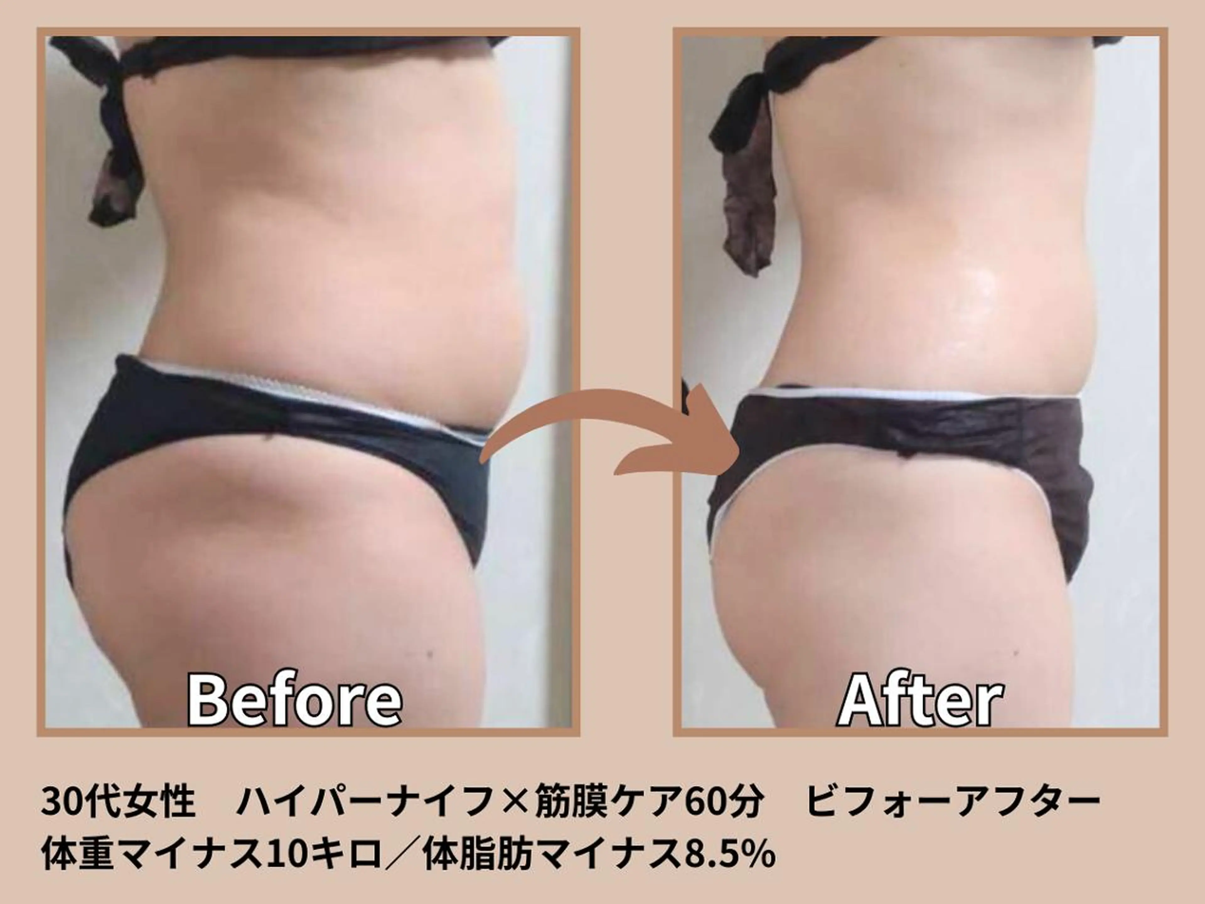 その他 痩身&小顔矯正専門店 Re:Livesのエステ・リラクイメージ