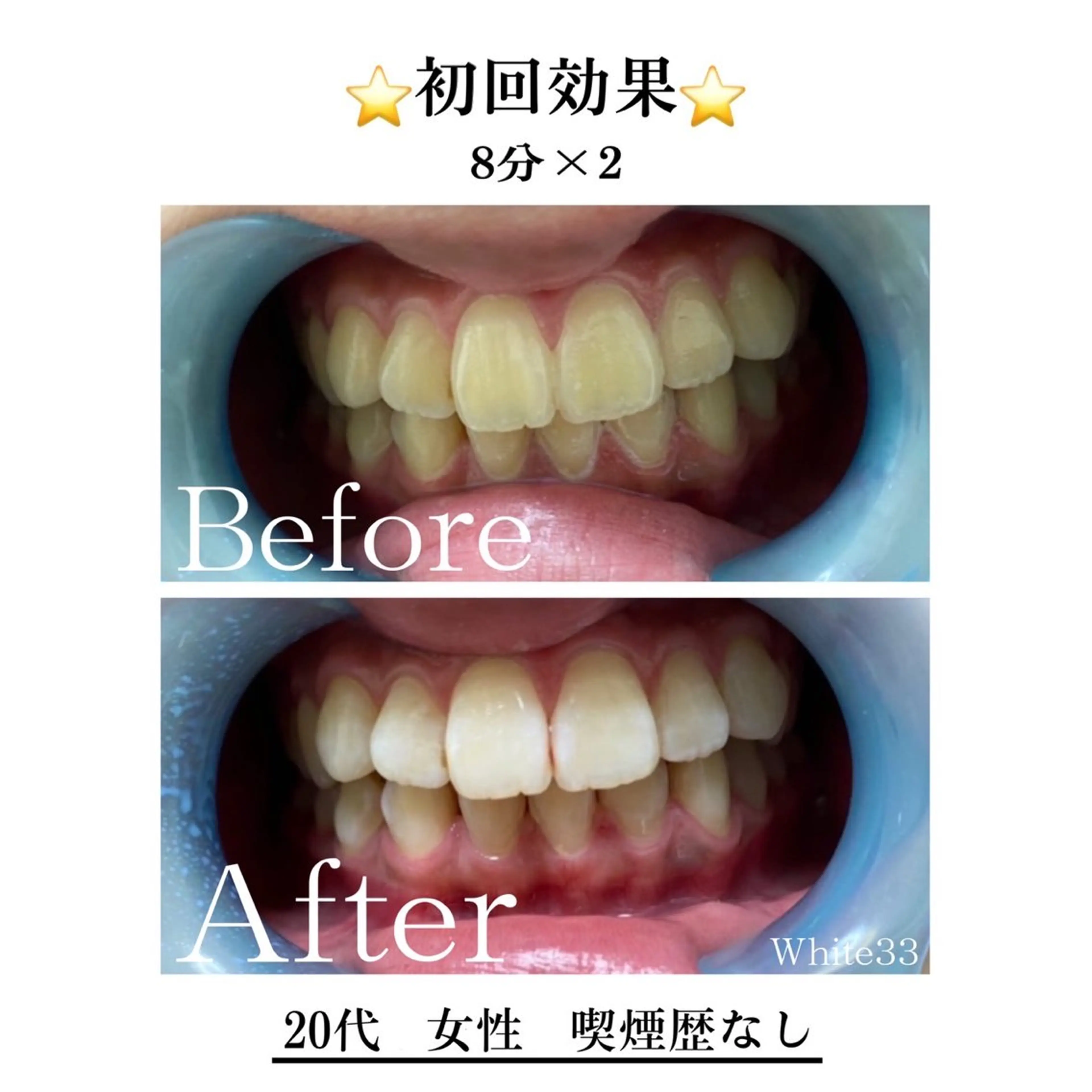 セルフホワイトニング White33大名のその他イメージ