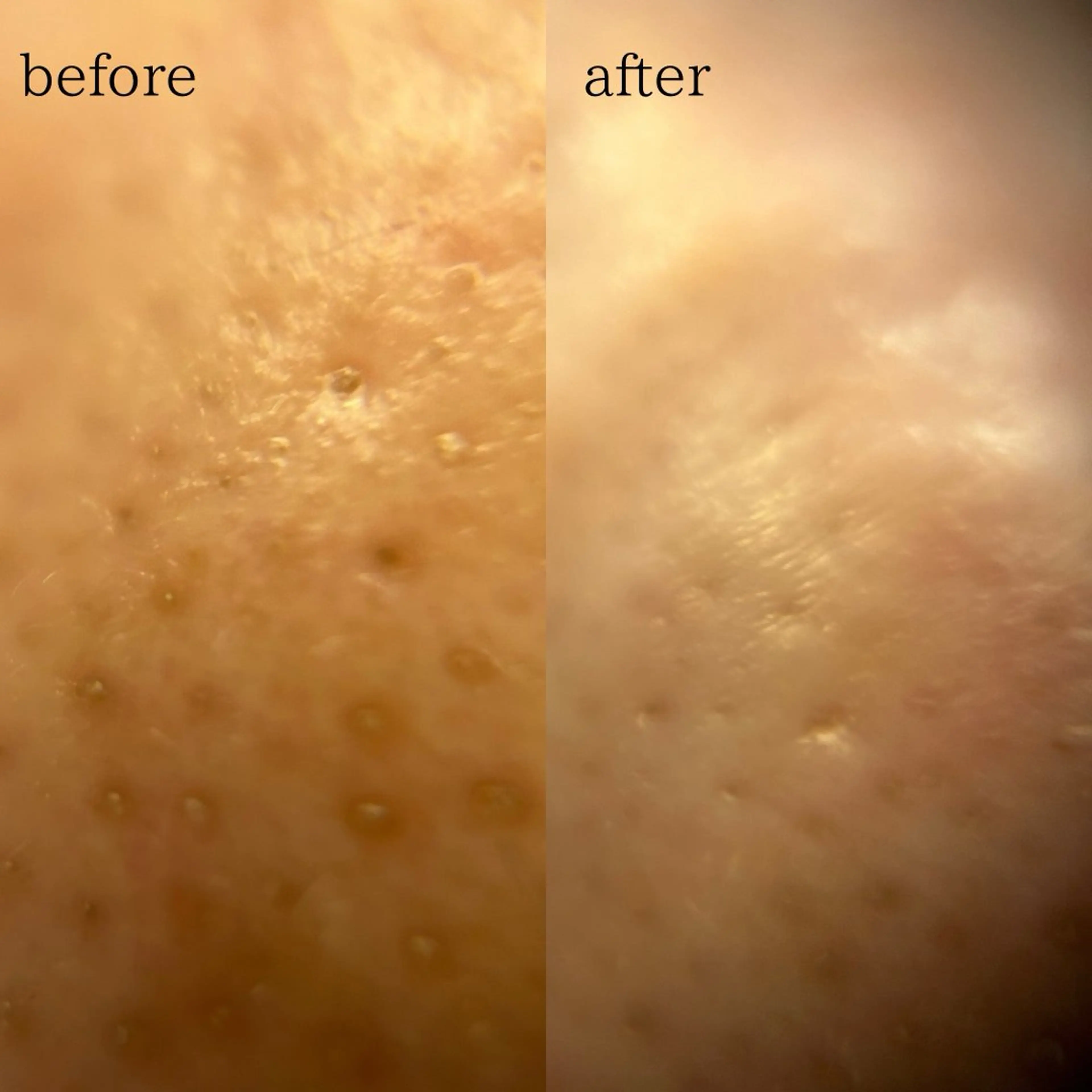 よもぎ蒸し×肌育【aju】所属・おかま直伝よもぎ蒸し 【aju】山本 亜樹のエステ・リラクイメージ