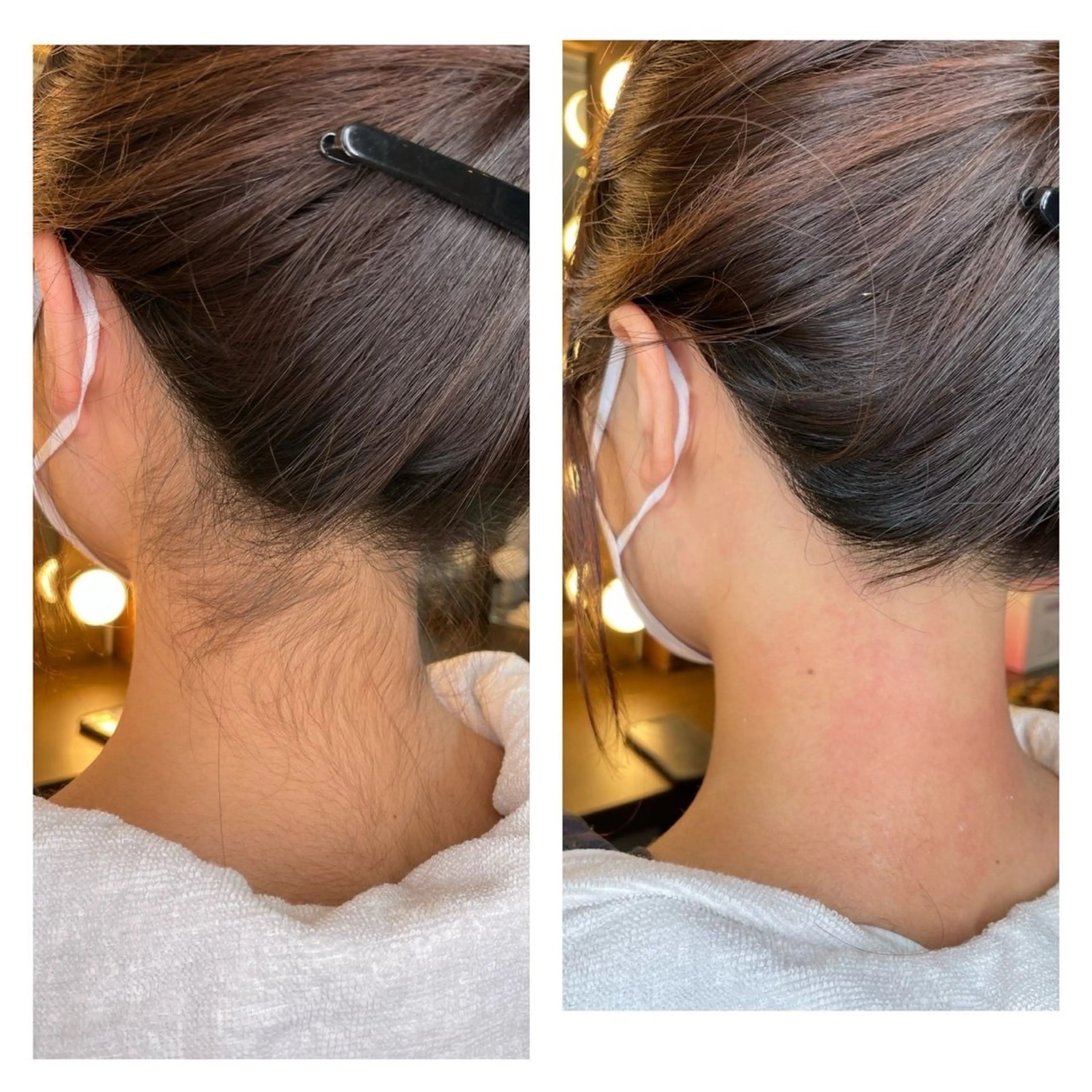 🌿練習モデル募集|うなじワックス🌿の写真